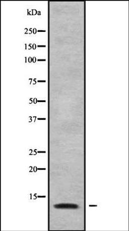 Western blot analysis of COLO205 whole cell lysates using MRPL34 antibody