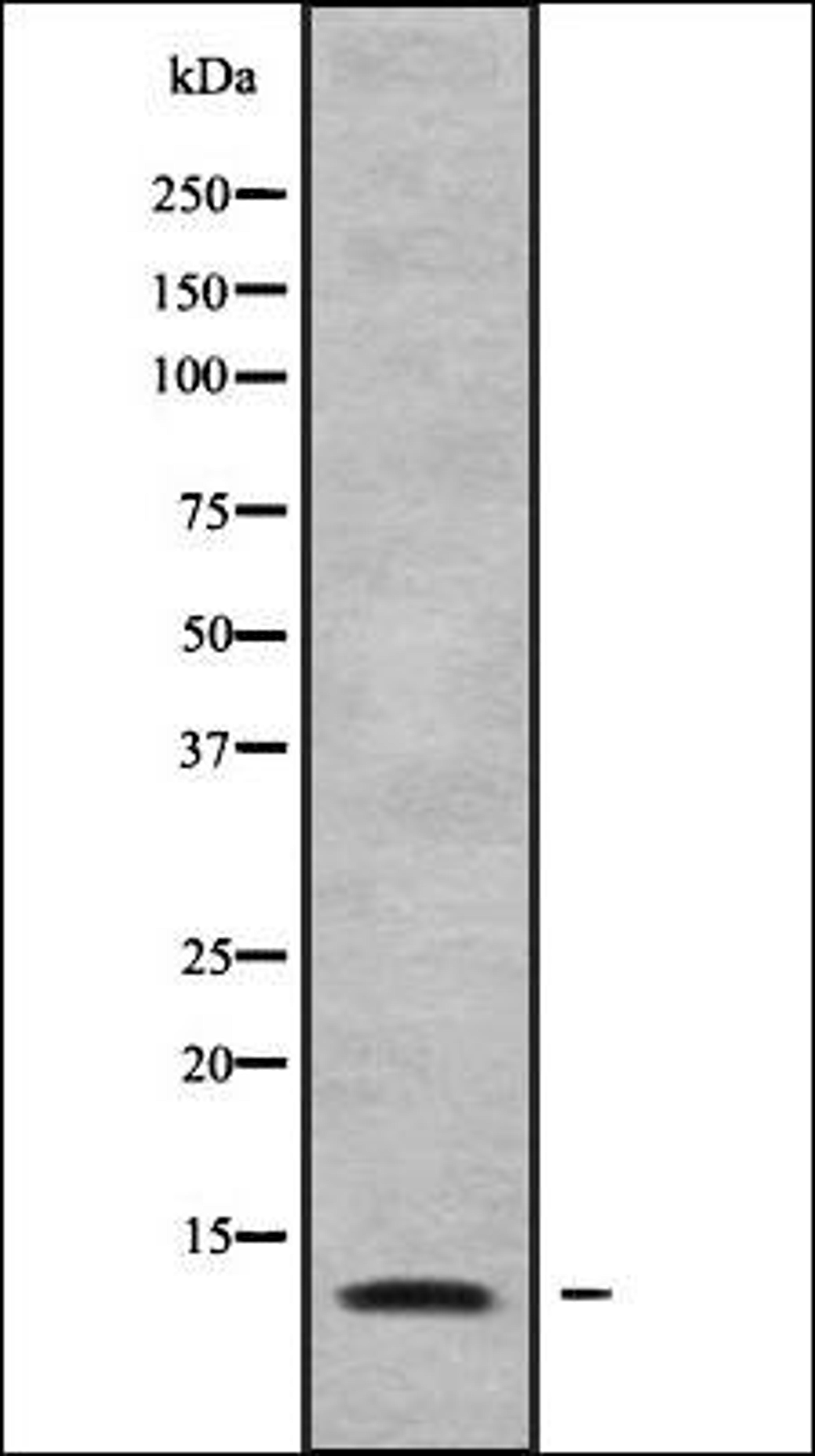 Western blot analysis of COLO205 whole cell lysates using MRPL34 antibody