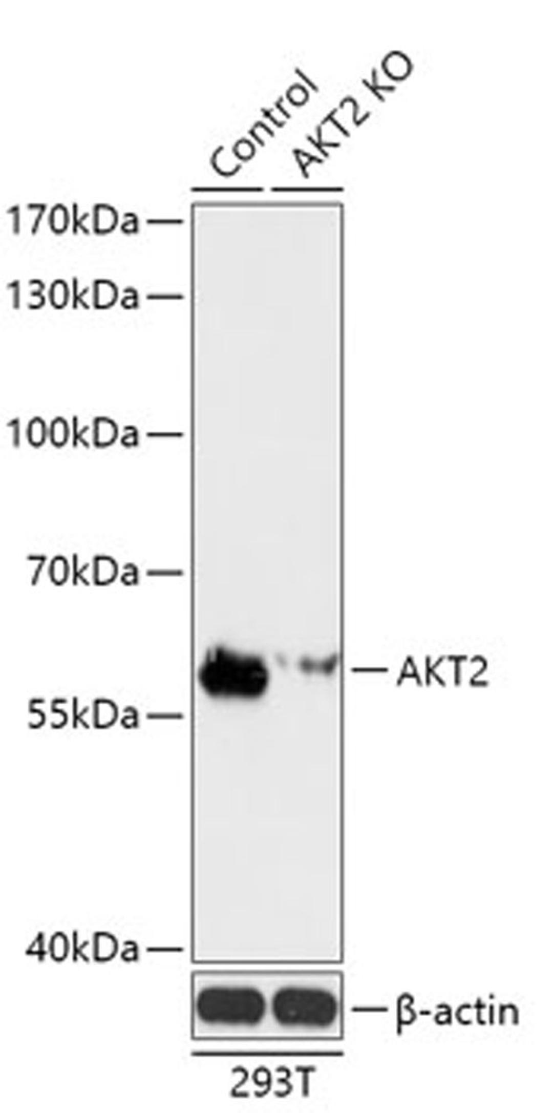 Western blot - AKT2 antibody (A18019)