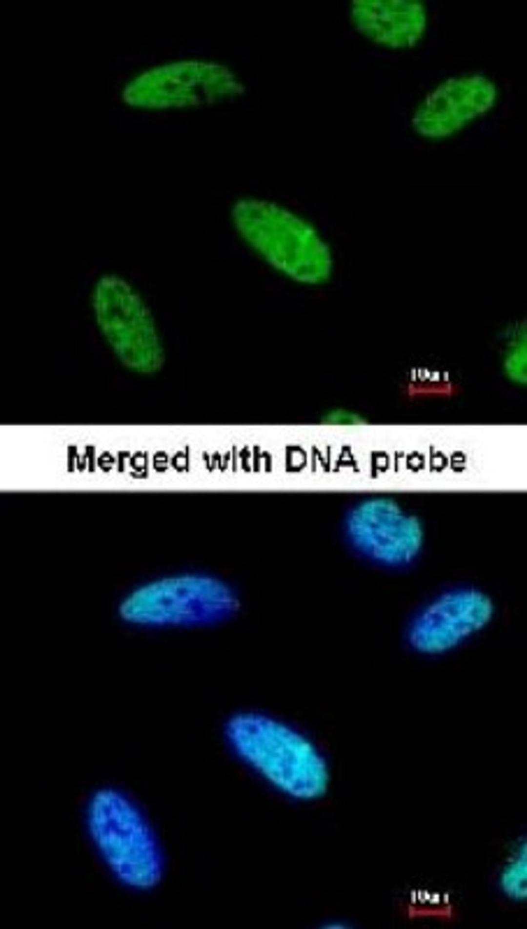 Immunocytochemistry/Immunofluorescence: DNAJC7 Antibody [NBP1-32127] - analysis of HeLa, using DNAJC7 antibody at 1:200 dilution.