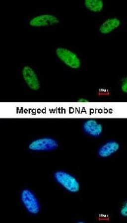 Immunocytochemistry/Immunofluorescence: DNAJC7 Antibody [NBP1-32127] - analysis of HeLa, using DNAJC7 antibody at 1:200 dilution.