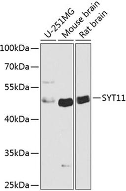 Western blot - SYT11 antibody (A8198)