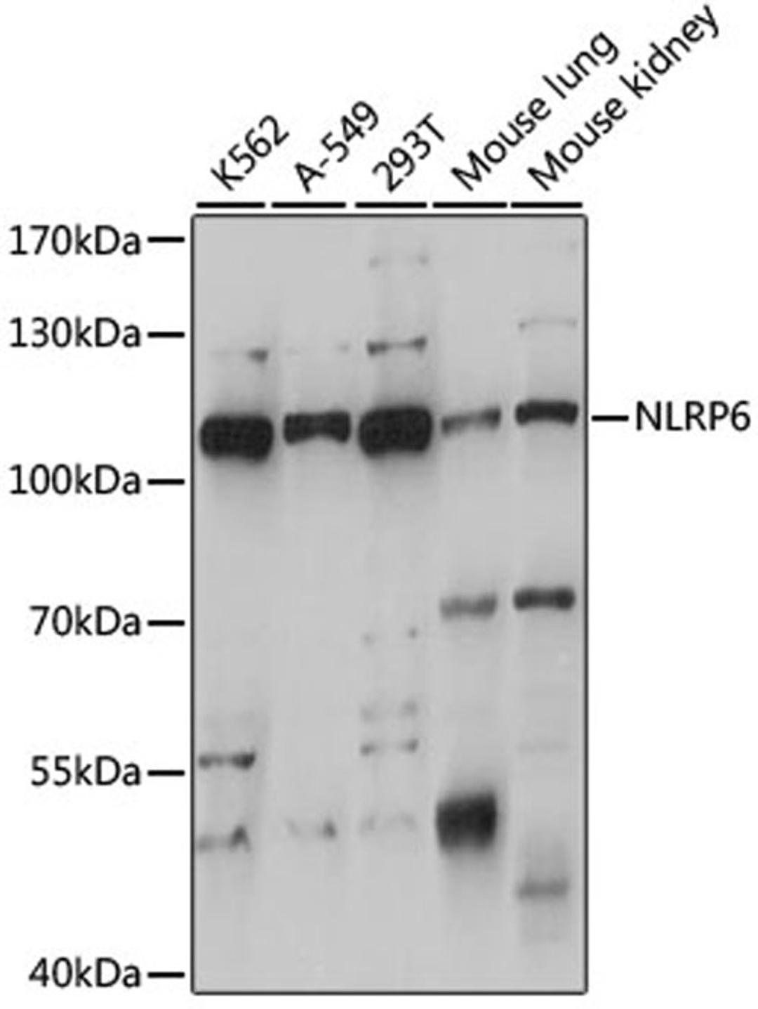 Western blot - NLRP6 antibody (A15628)