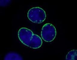 Detection of human TPR by immunocytochemistry.