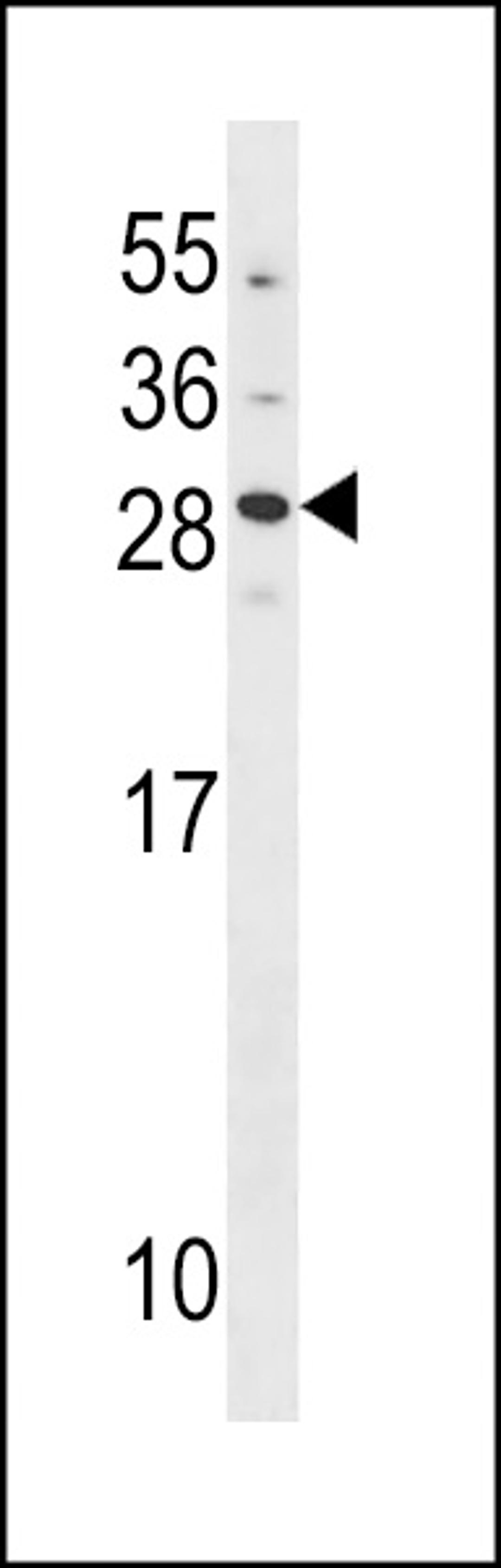 Western blot analysis in A549 cell line lysates (35ug/lane).