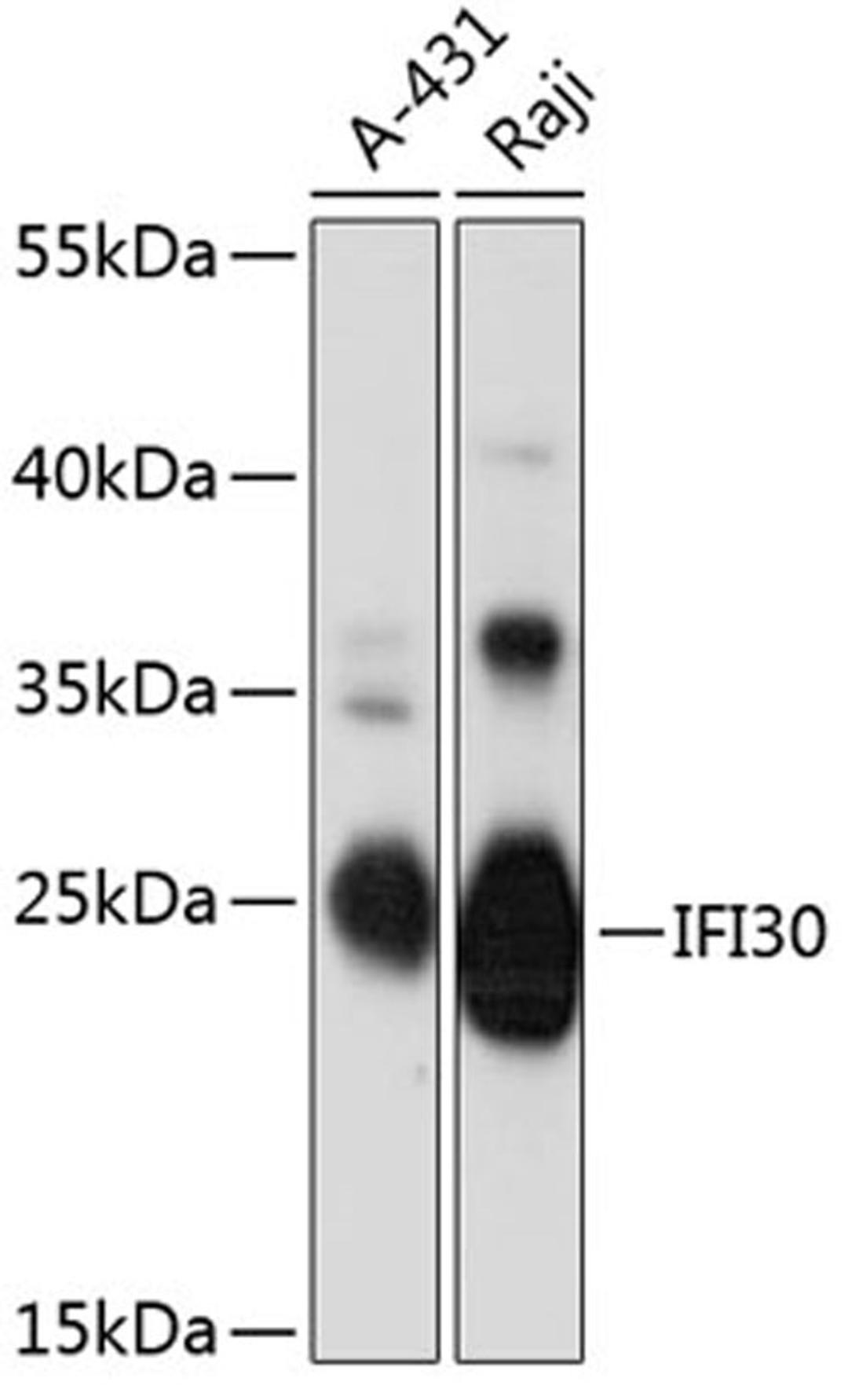 Western blot - IFI30 antibody (A12995)