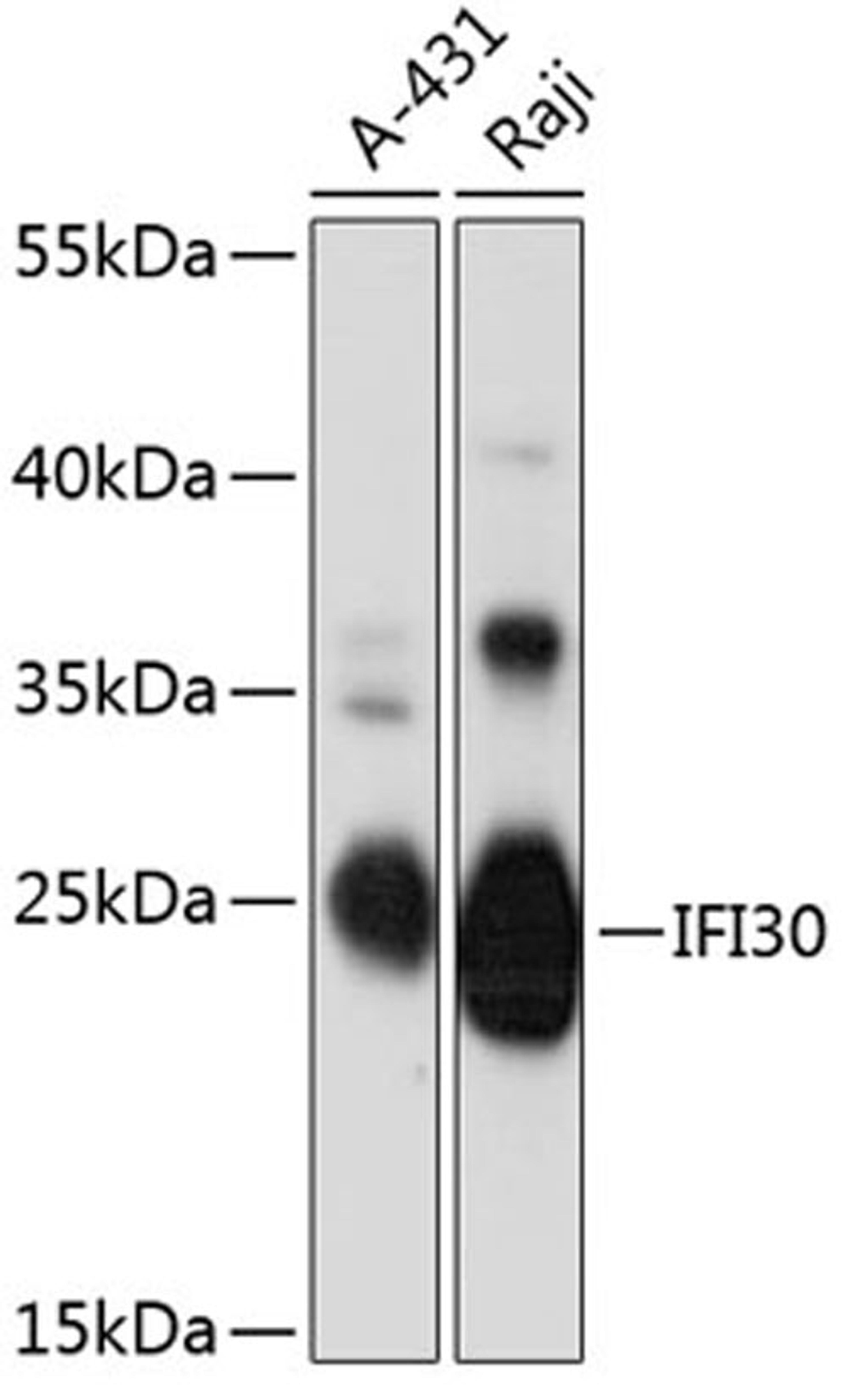 Western blot - IFI30 antibody (A12995)