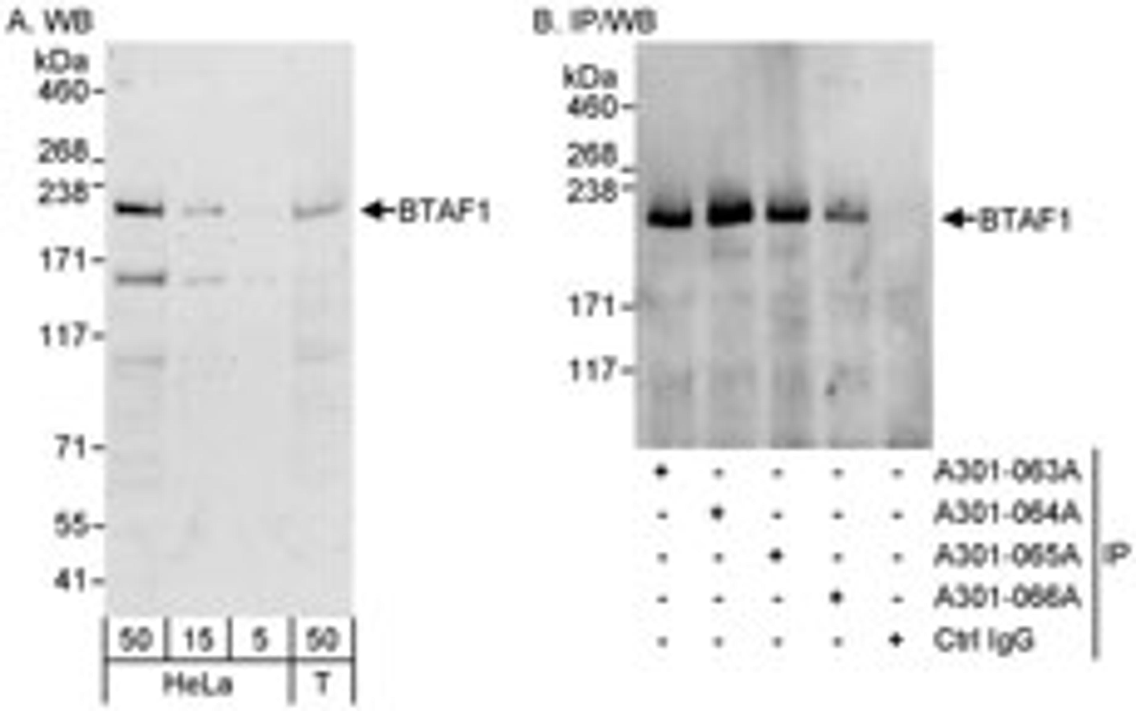 Detection of human BTAF1 by western blot and immunoprecipitation.