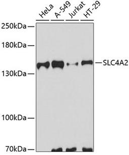 Western blot - SLC4A2 antibody (A7729)