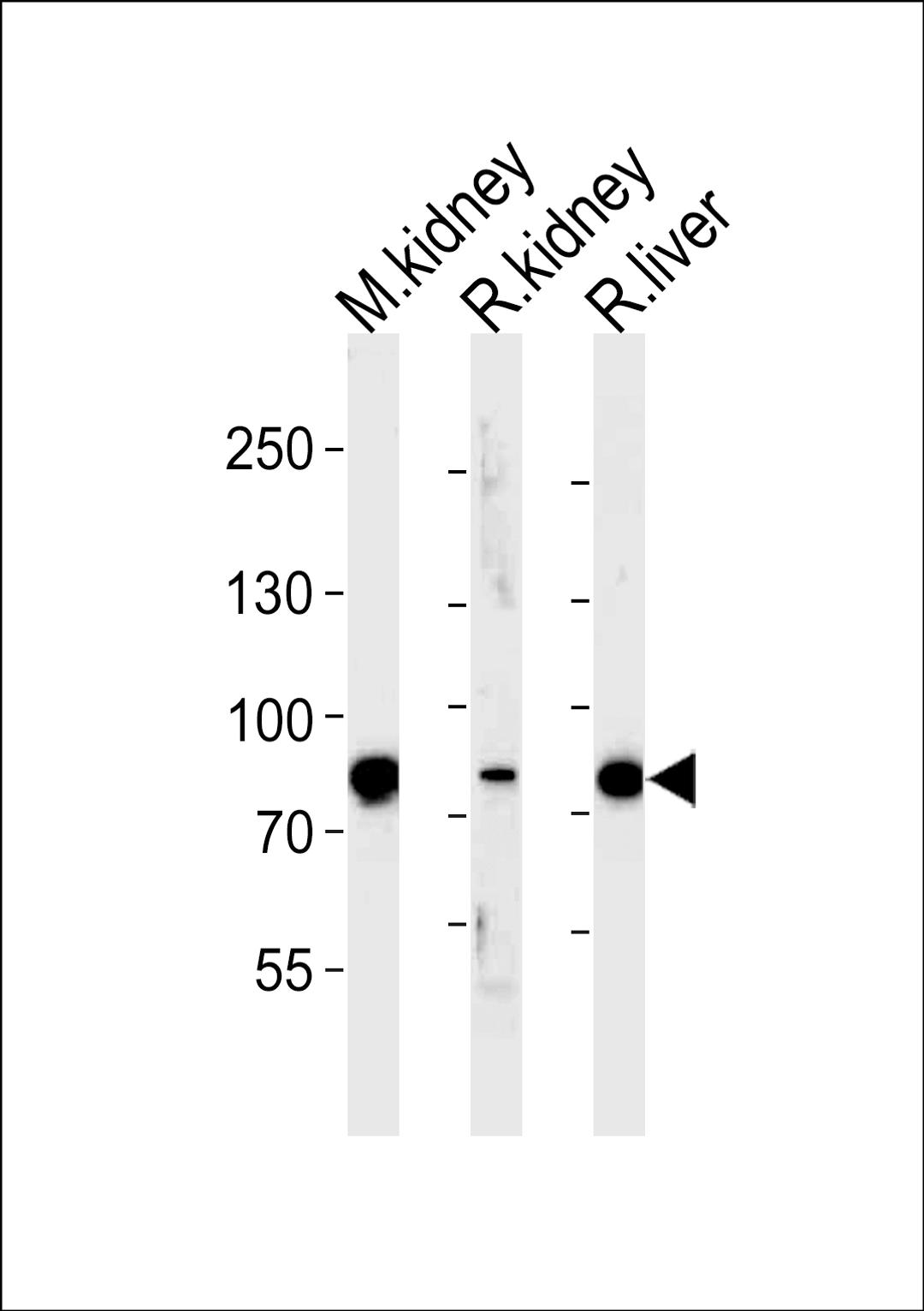 Western blot analysis of lysates from mousr kidney, rat kidney and liver tissue (from left to right), using EHHADH Antibody at 1:1000 at each lane.