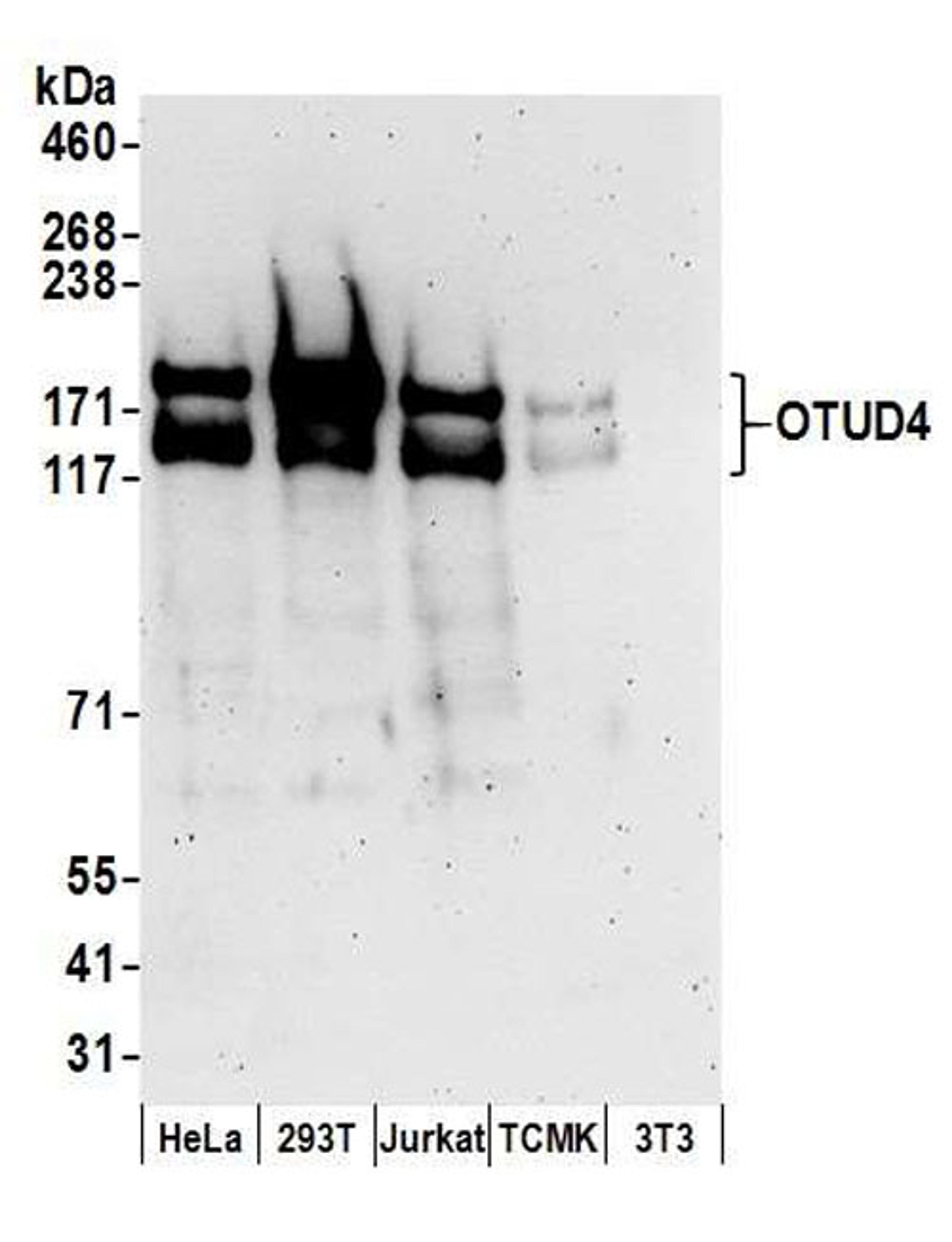 Detection of human and mouse OTUD4 by WB.