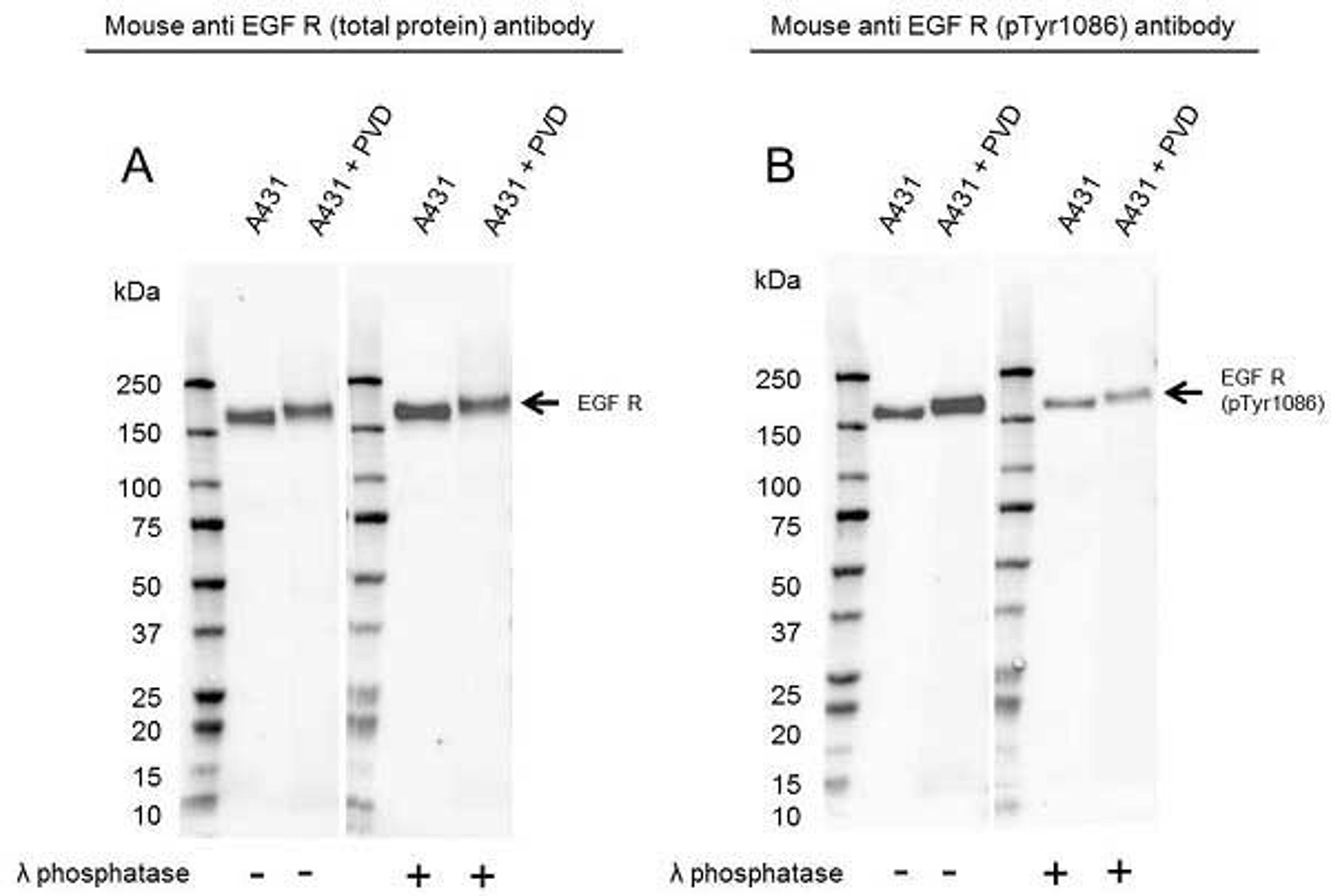 Western Blot analysis of A431 untreated and pervanadate treated whole cell lysate