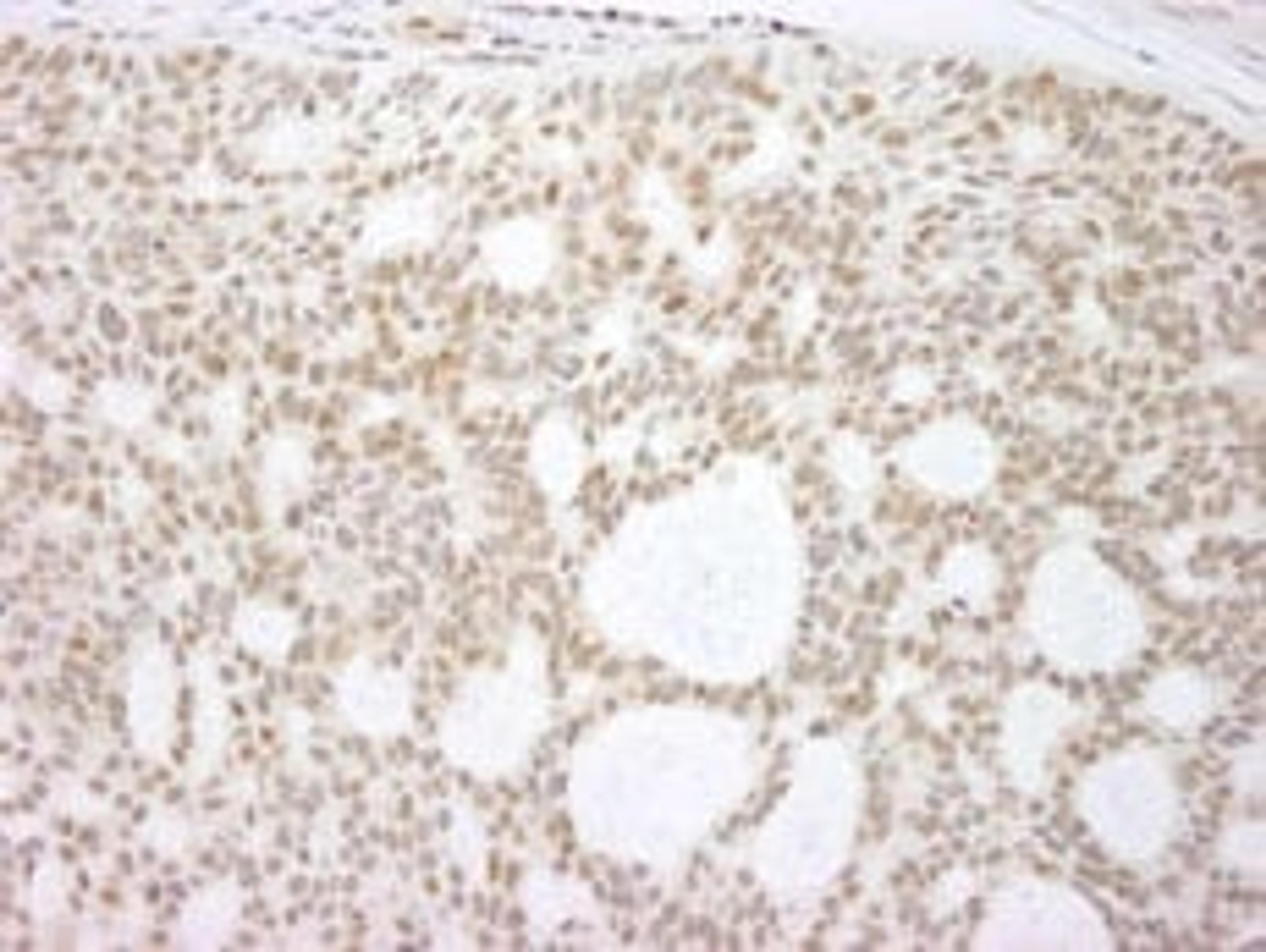 Detection of human p73 by immunohistochemistry.