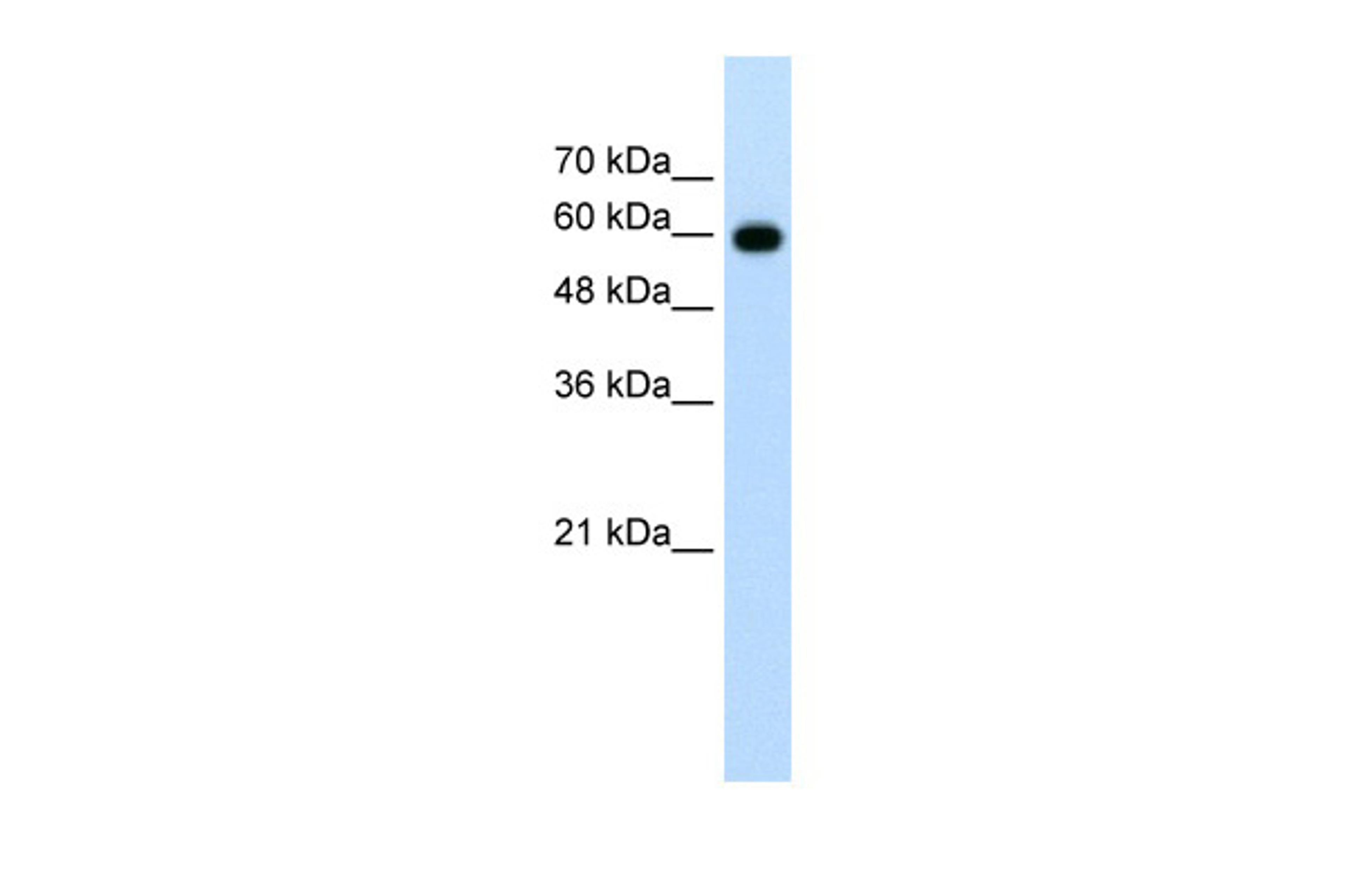 Antibody used in WB on Human Jurkat 1.25 ug/ml.