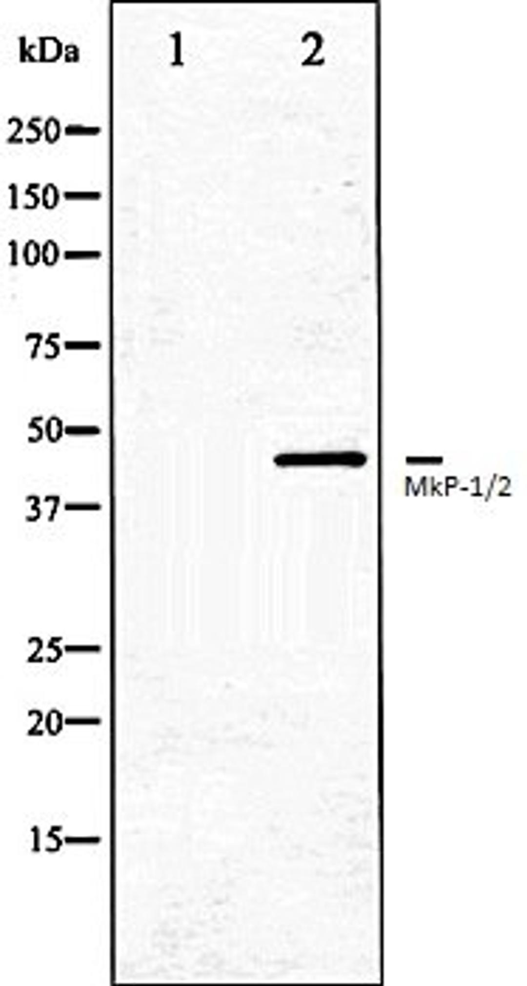 Western blot analysis of Jurkat whole cell lysates using MKP-1/2 antibody, The lane on the left is treated with the antigen-specific peptide.