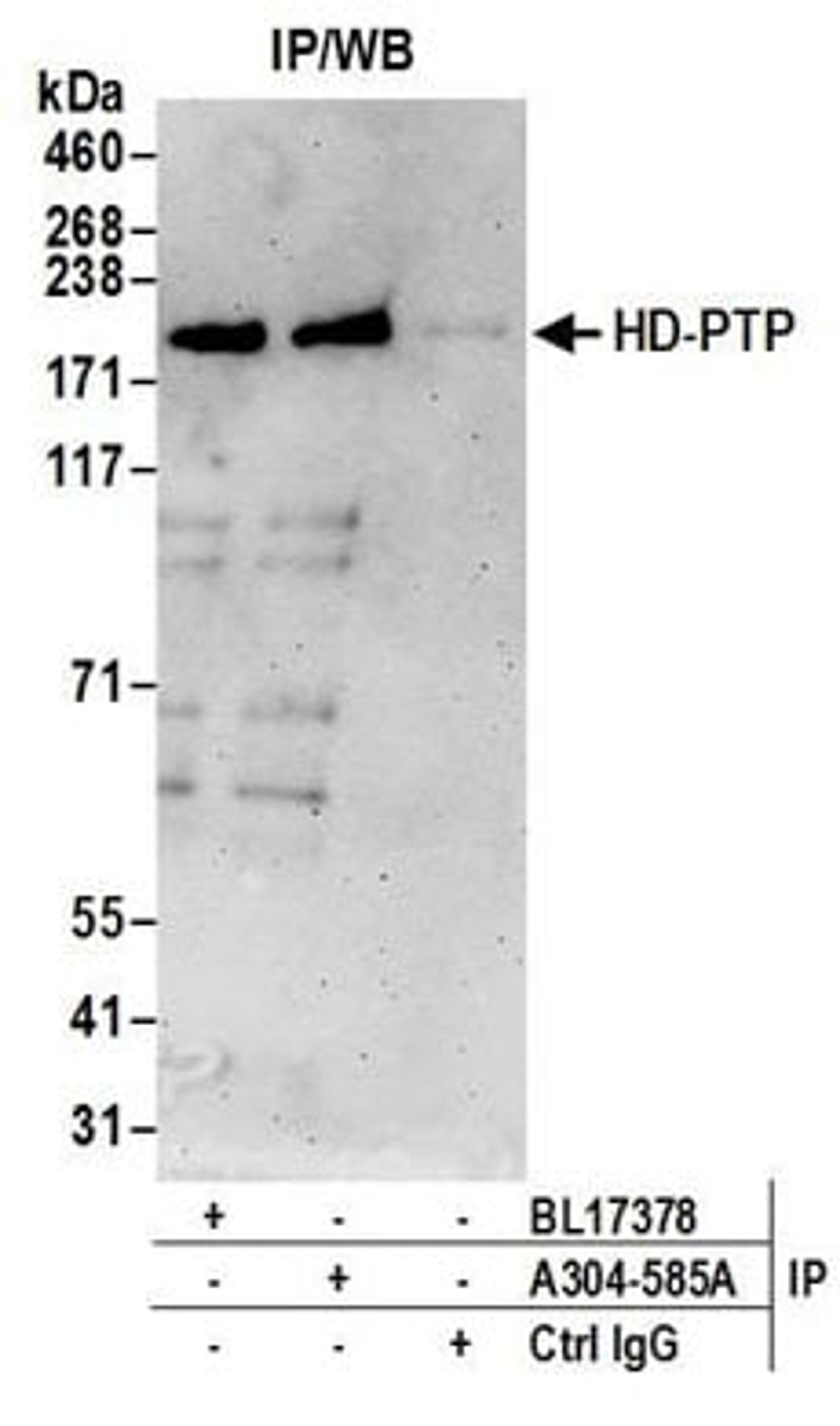 Detection of human HD-PTP by western blot of immunoprecipitates.