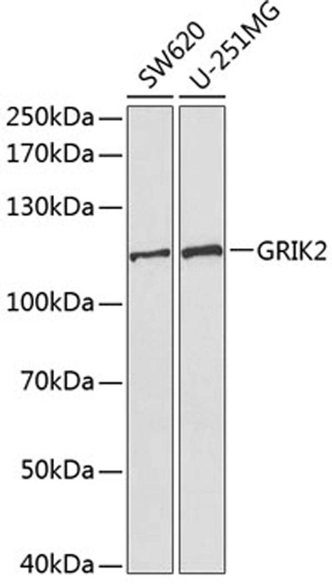 Western blot - GRIK2 antibody (A1939)