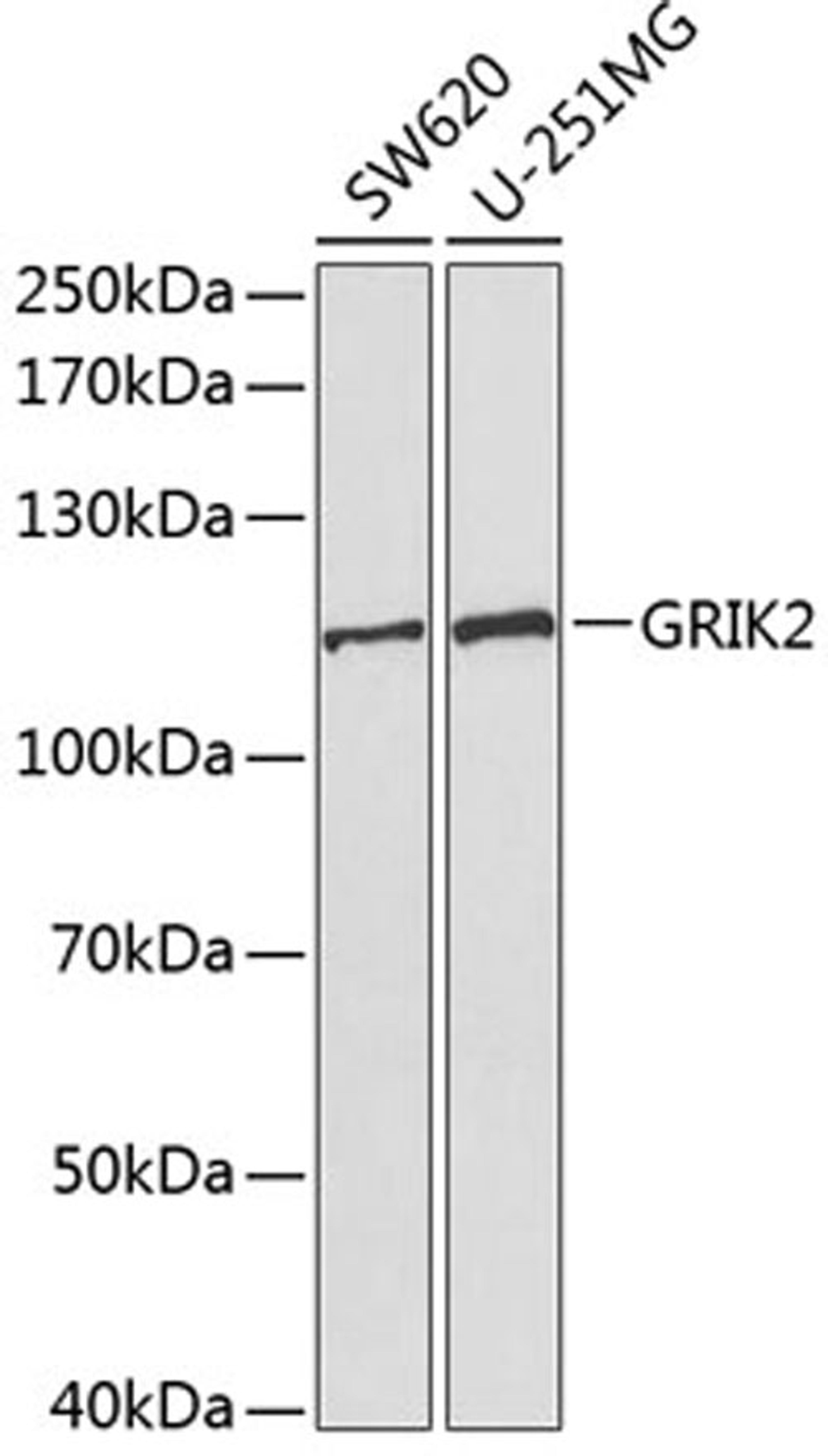 Western blot - GRIK2 antibody (A1939)