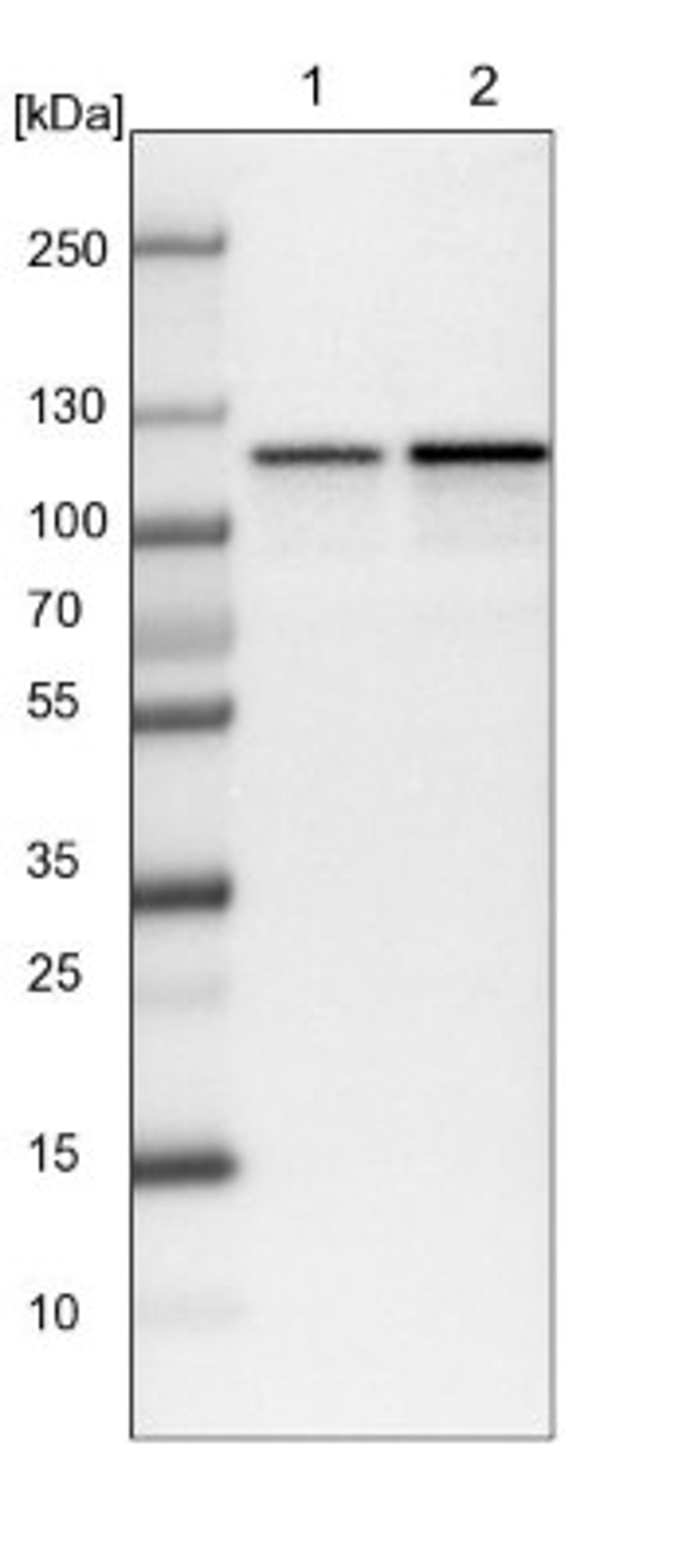 Western Blot: HSPH1/HSP105 Antibody [NBP1-89662] - Lane 1: NIH-3T3 cell lysate (Mouse embryonic fibroblast cells)<br/>Lane 2: NBT-II cell lysate (Rat Wistar bladder tumour cells)