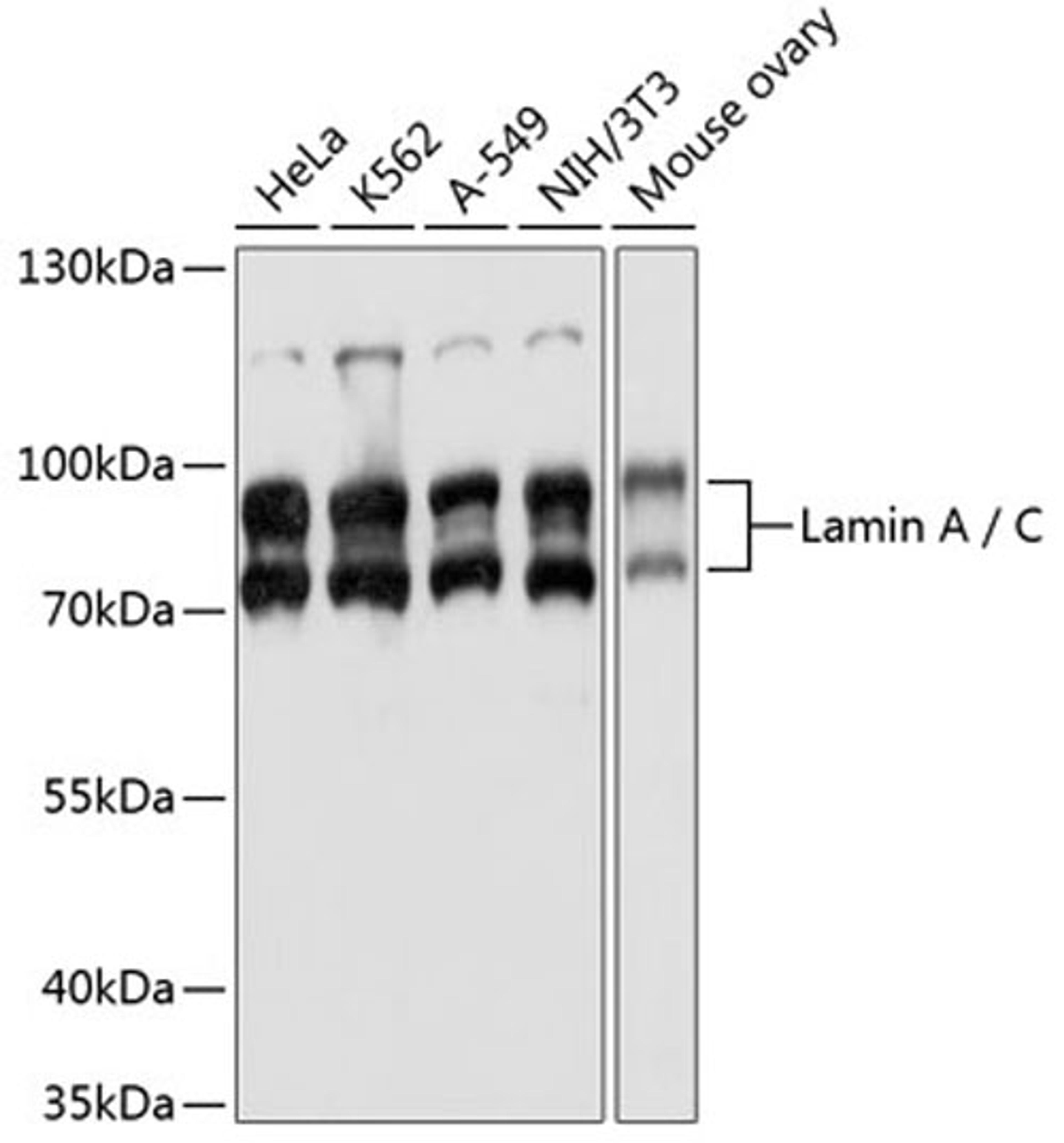 Western blot - Lamin A / C antibody (A17319)