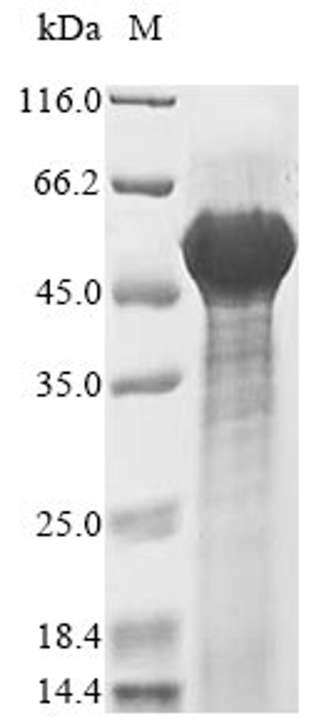 (Tris-Glycine gel) Discontinuous SDS-PAGE (reduced) with 5% enrichment gel and 15% separation gel.