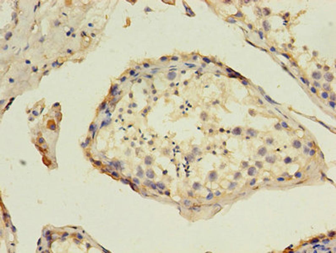 Immunohistochemistry of paraffin-embedded human testis tissue using CSB-PA09995A0Rb at dilution of 1:100