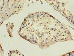 Immunohistochemistry of paraffin-embedded human testis tissue using CSB-PA09995A0Rb at dilution of 1:100