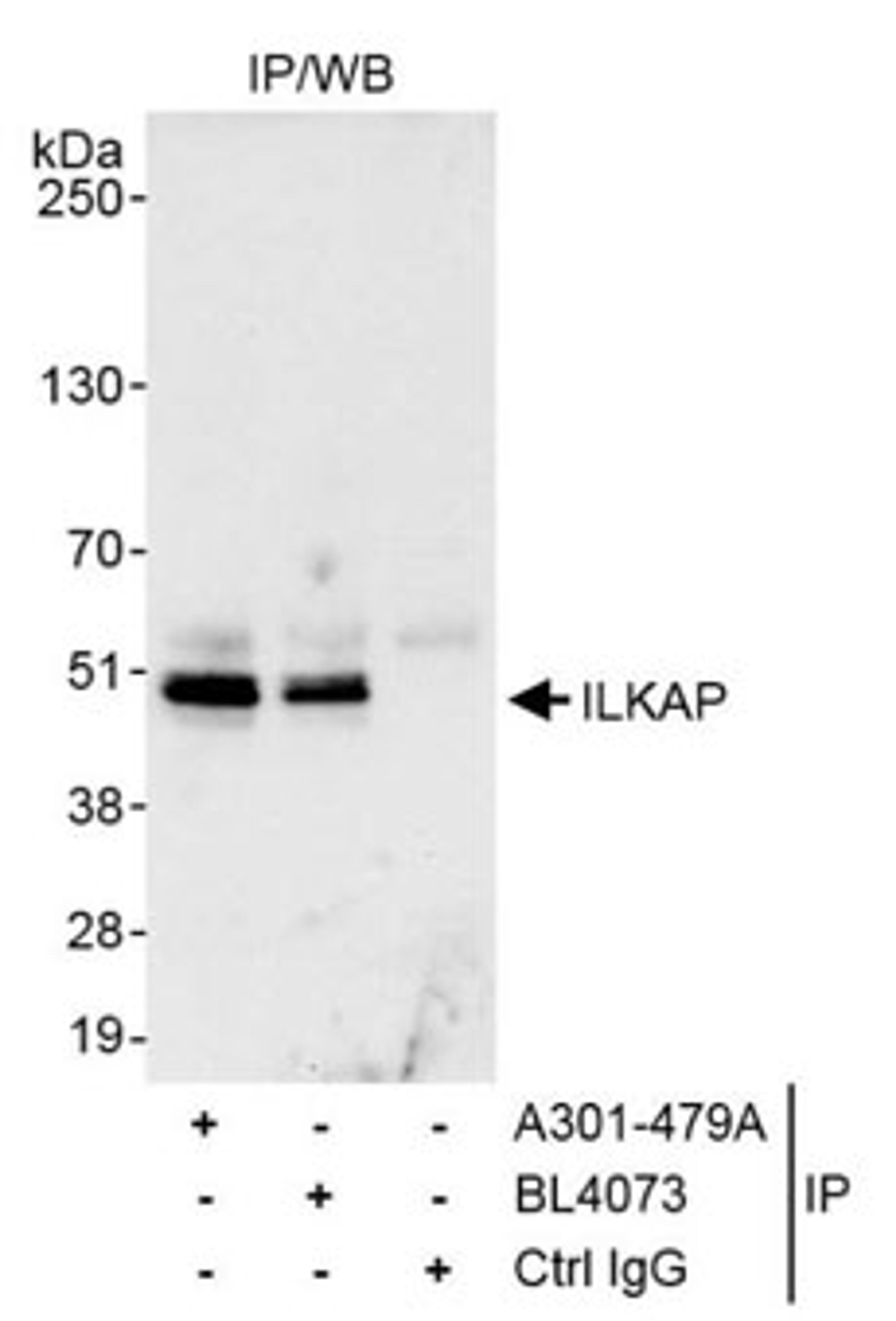 Detection of human ILKAP by western blot of immunoprecipitates.