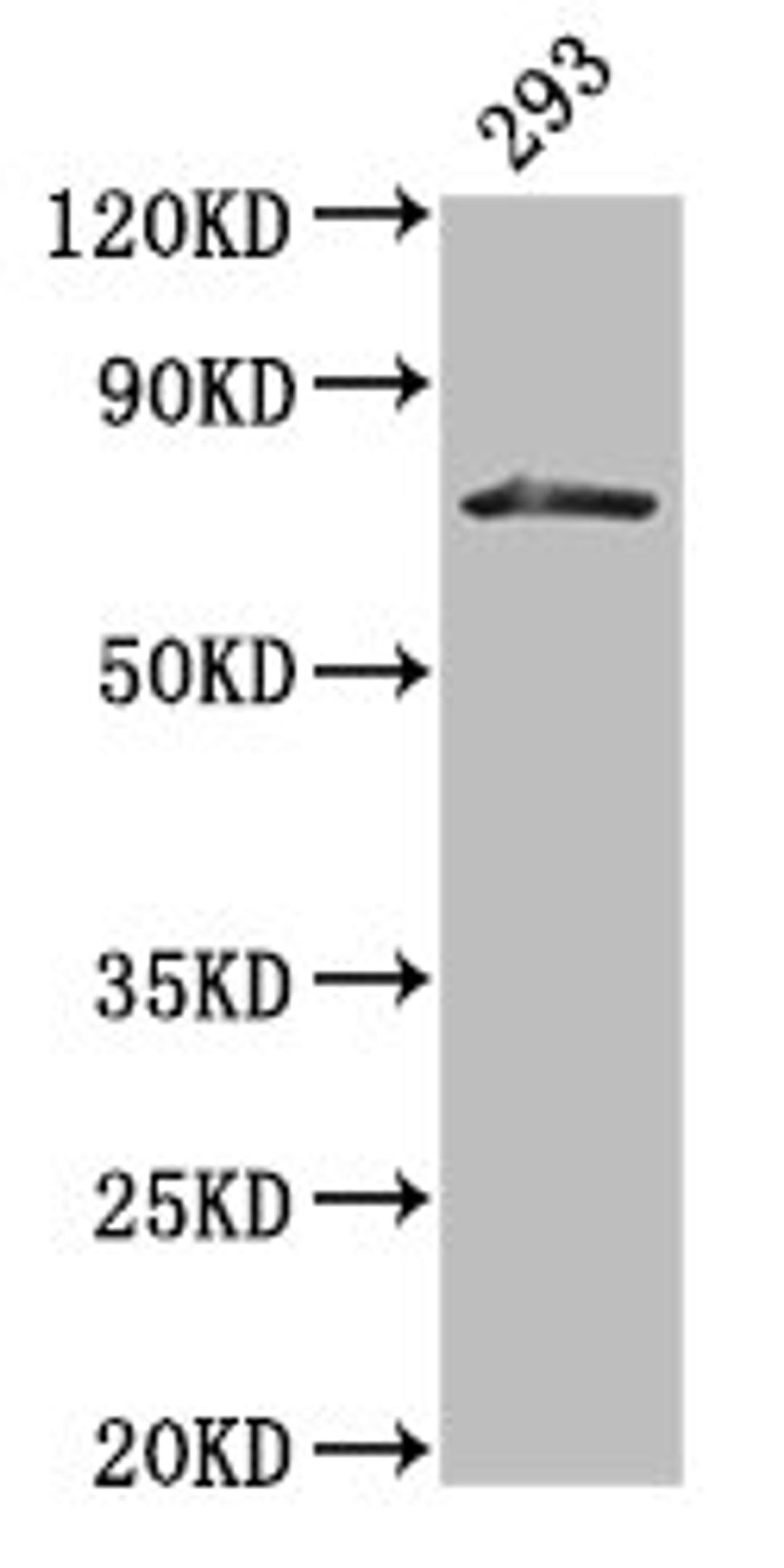 Western Blot. Positive WB detected in: 293 whole cell lysate. All lanes: HDC antibody at 3µg/ml. Secondary. Goat polyclonal to rabbit IgG at 1/50000 dilution. Predicted band size: 75, 71 kDa. Observed band size: 75 kDa