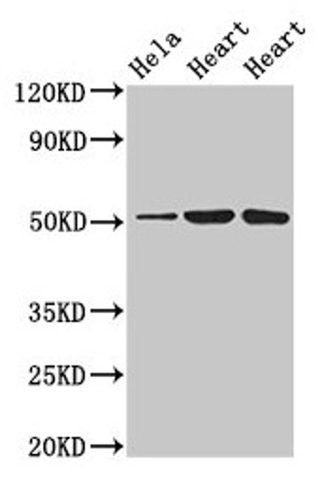 Western Blot. Positive WB detected in: Hela whole cell lysate, Rat heart tissue, Mouse heart tissue. All lanes: ATP1B1 antibody at 3µg/ml. Secondary. Goat polyclonal to rabbit IgG at 1/50000 dilution. Predicted band size: 36, 35 kDa. Observed band size: 52 kDa