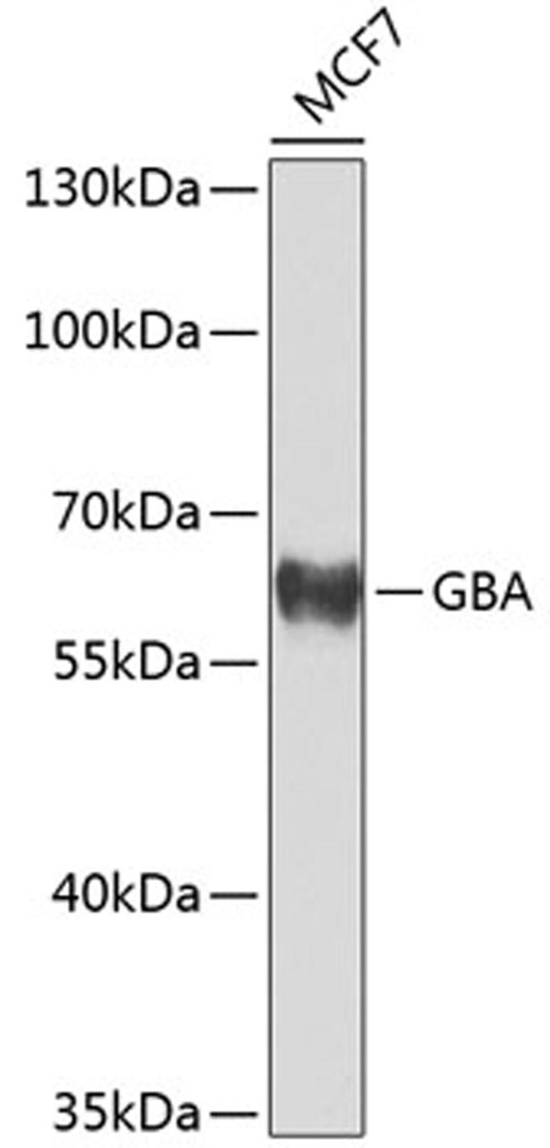 Western blot - GBA antibody (A8420)