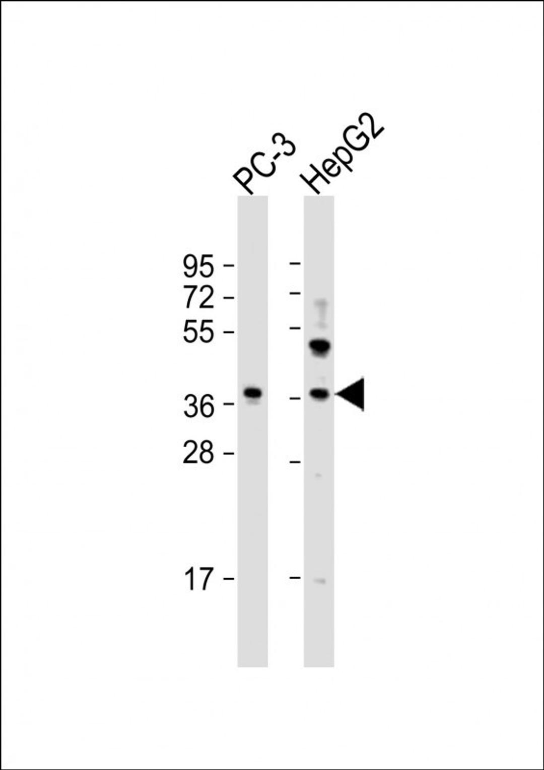 Western Blot at 1:2000 dilution Lane 1: PC-3 whole cell lysate Lane 2: HepG2 whole cell lysate Lysates/proteins at 20 ug per lane.