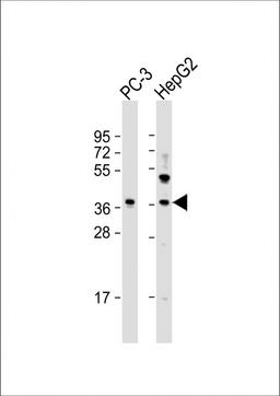 Western Blot at 1:2000 dilution Lane 1: PC-3 whole cell lysate Lane 2: HepG2 whole cell lysate Lysates/proteins at 20 ug per lane.