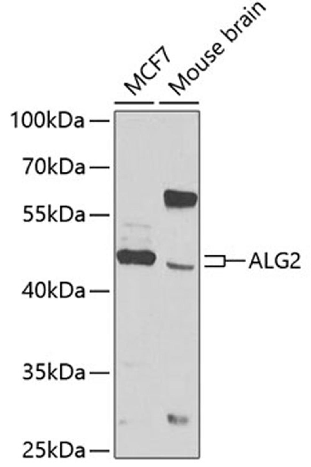 Western blot - ALG2 antibody (A7843)