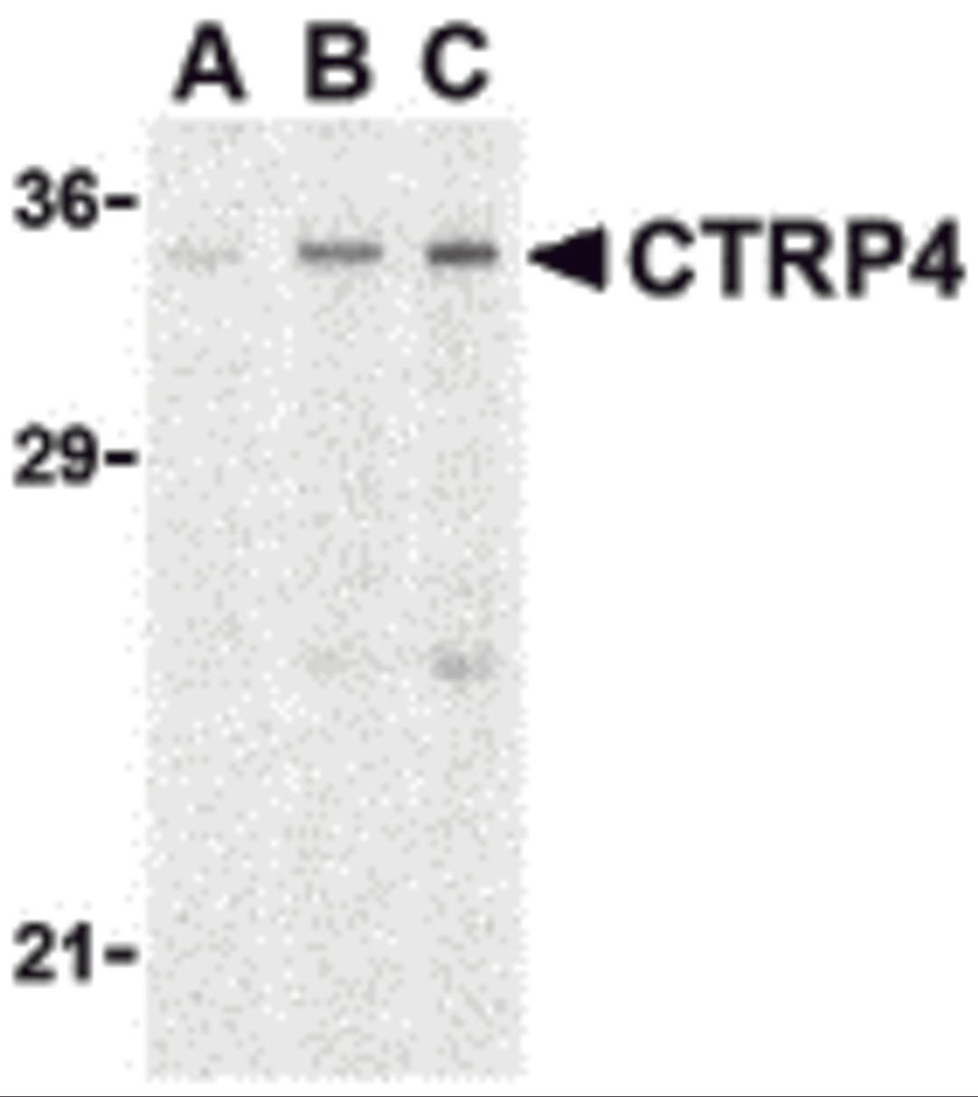 Western blot analysis of CTRP4 in rat brain cell lysate with CTRP4 antibody at (A) 1, (B) 2, and (C) 4 &#956;g/mL. 