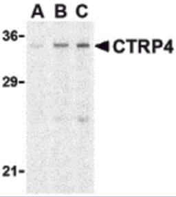 Western blot analysis of CTRP4 in rat brain cell lysate with CTRP4 antibody at (A) 1, (B) 2, and (C) 4 &#956;g/mL. 