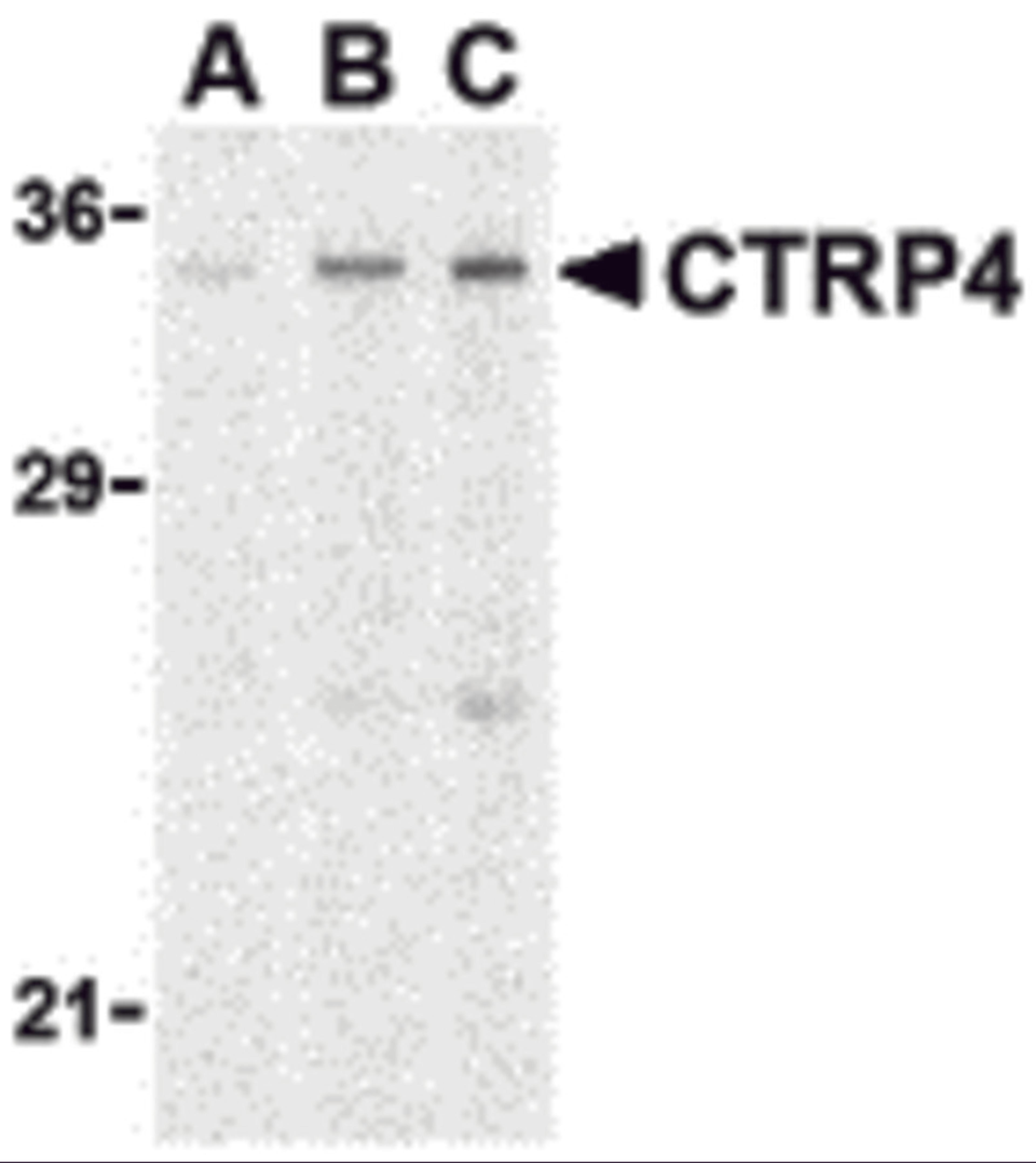 Western blot analysis of CTRP4 in rat brain cell lysate with CTRP4 antibody at (A) 1, (B) 2, and (C) 4 μg/mL.