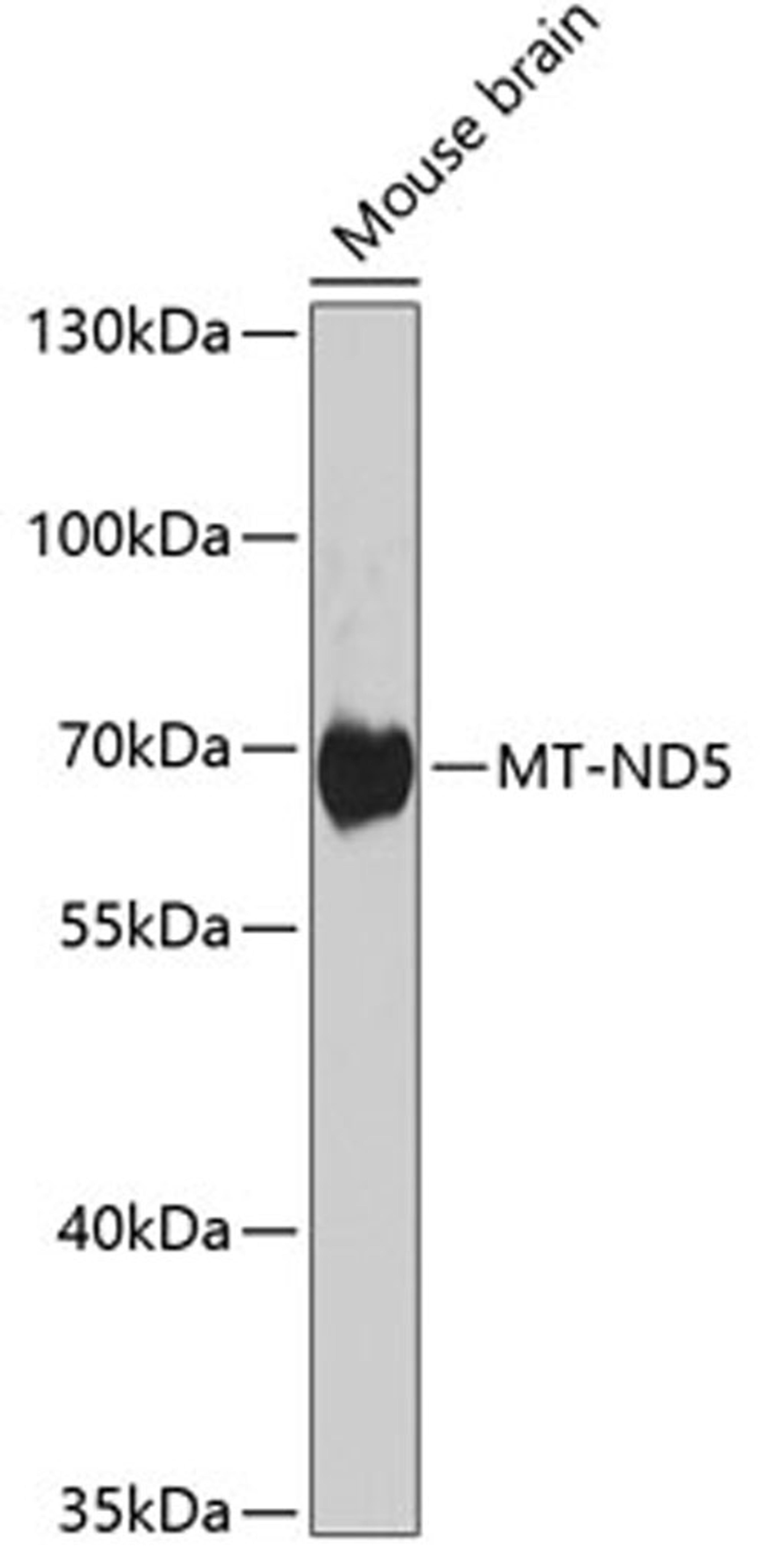 Western blot - MT-ND5 antibody (A8135)