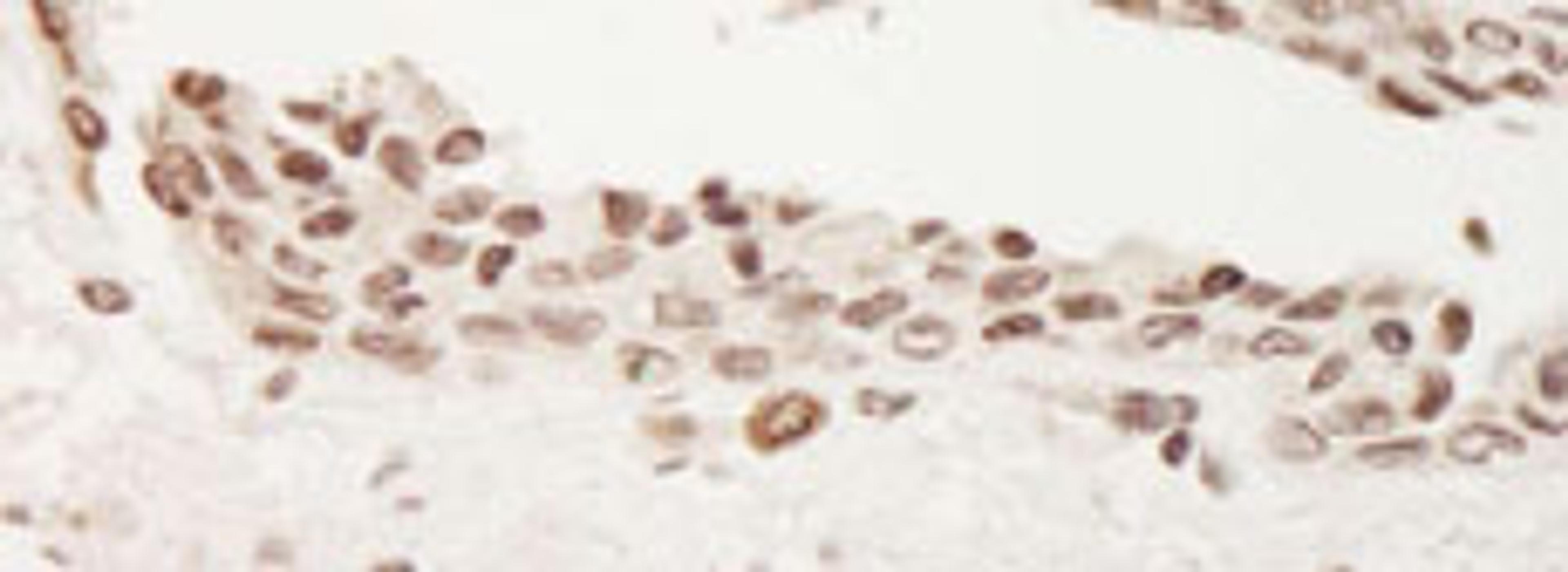 Detection of human TORC2 by immunohistochemistry.