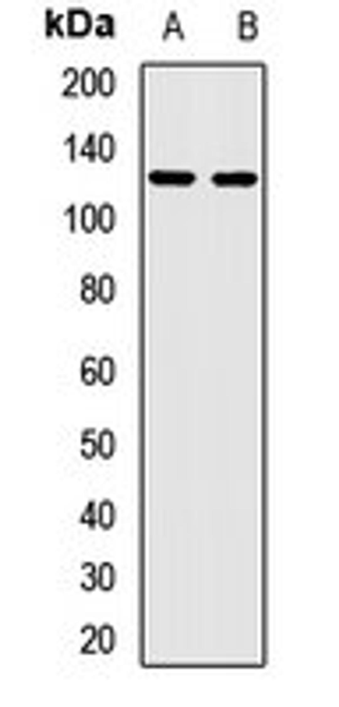 Western blot analysis of U87 (Lane1), rat kidney (Lane2) whole cell lysates using KIFC3 antibody