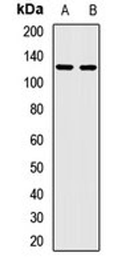 Western blot analysis of U87 (Lane1), rat kidney (Lane2) whole cell lysates using KIFC3 antibody