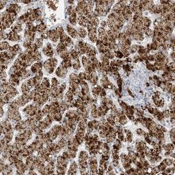 Immunohistochemistry-Paraffin: AGXT Antibody [NBP1-89200] - Staining of human liver shows strong cytoplasmic positivity in granular pattern in hepatocytes.