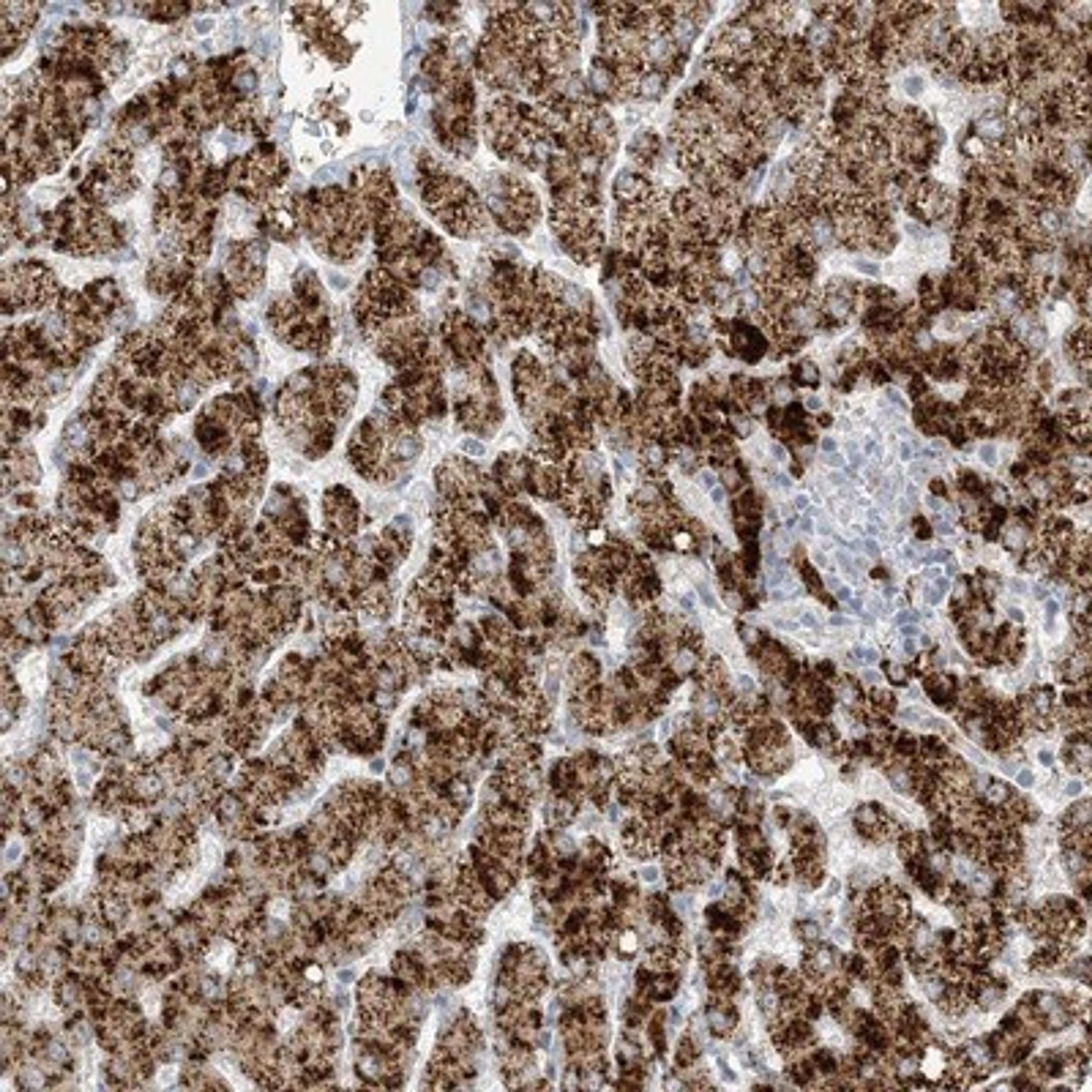 Immunohistochemistry-Paraffin: AGXT Antibody [NBP1-89200] - Staining of human liver shows strong cytoplasmic positivity in granular pattern in hepatocytes.