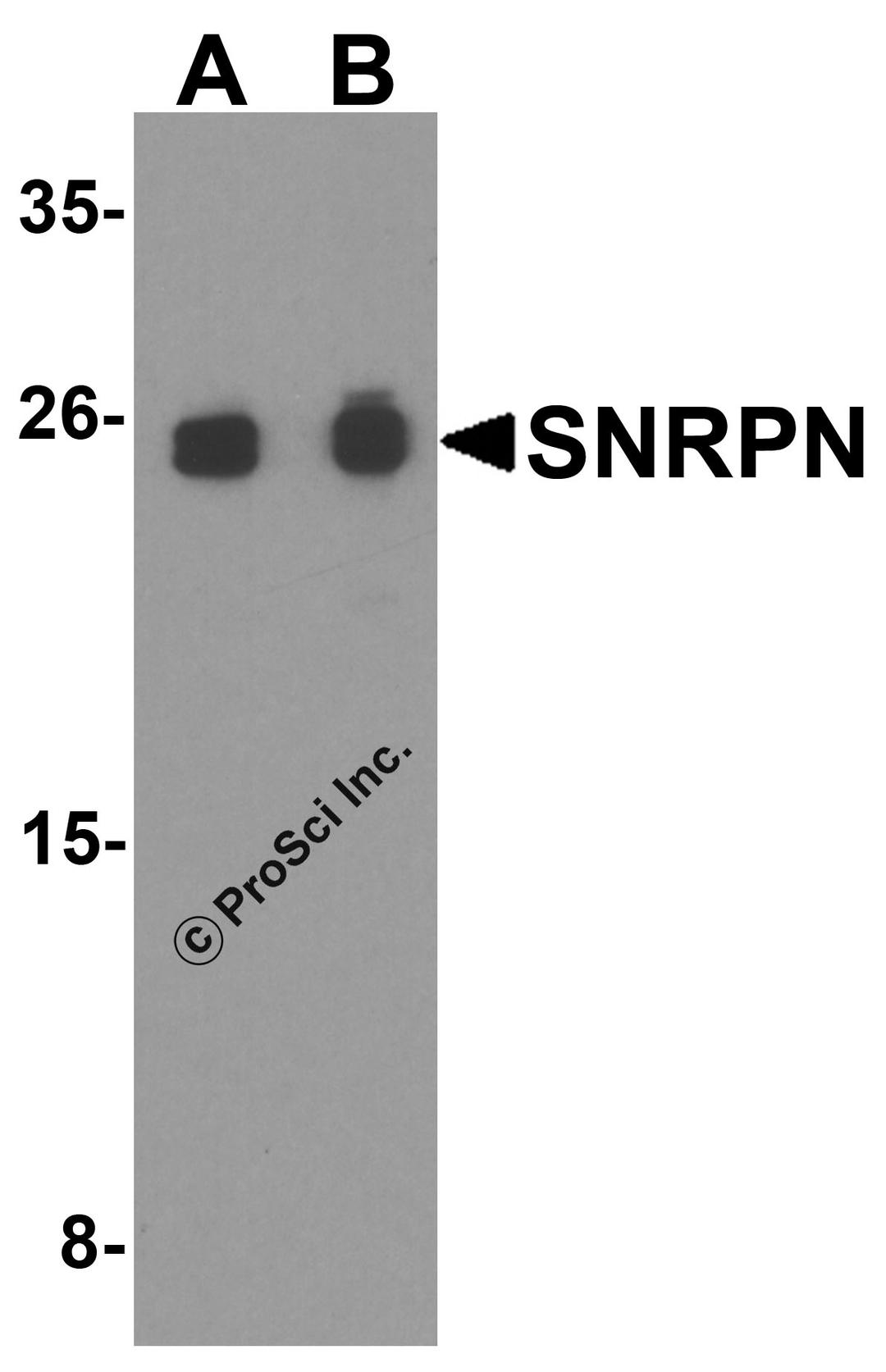 Western blot analysis of SNRPN in THP-1 cell lysate with SNRPN antibody at (A) 0.5 and (B) 1 μg/ml.