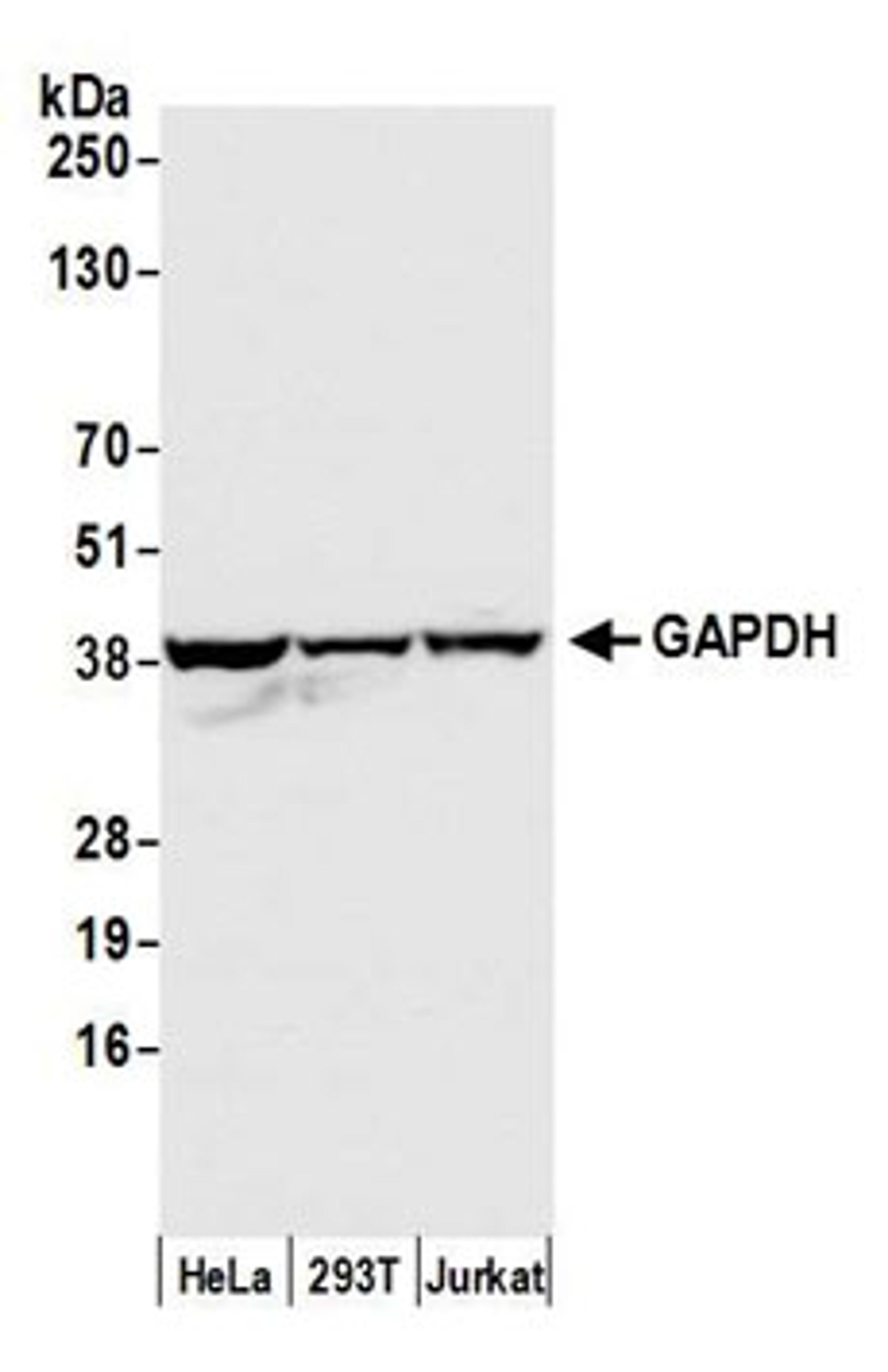 Detection of human GAPDH by western blot.