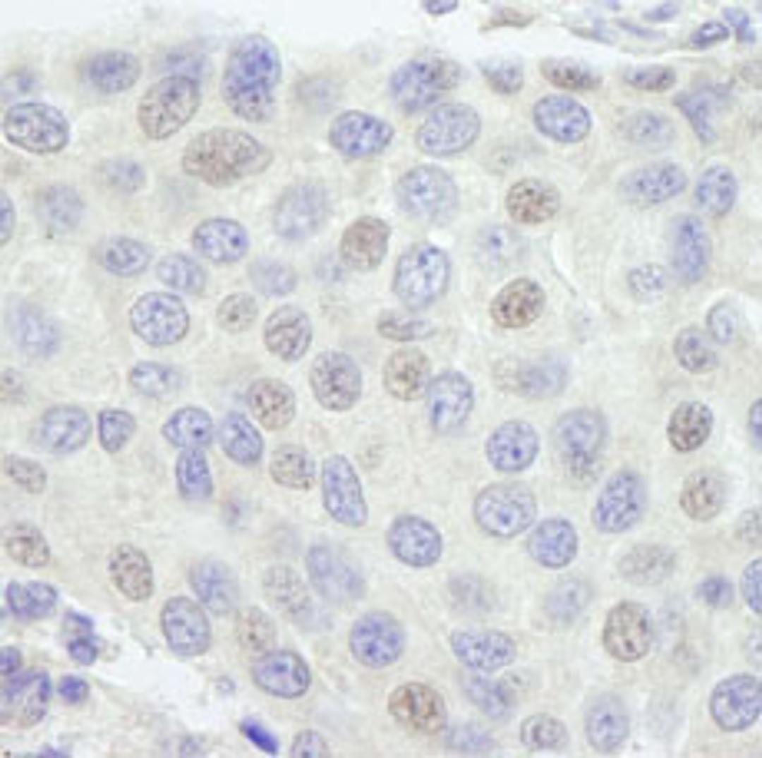 Detection of human GTF3C1/TFIIIC220 by immunohistochemistry.