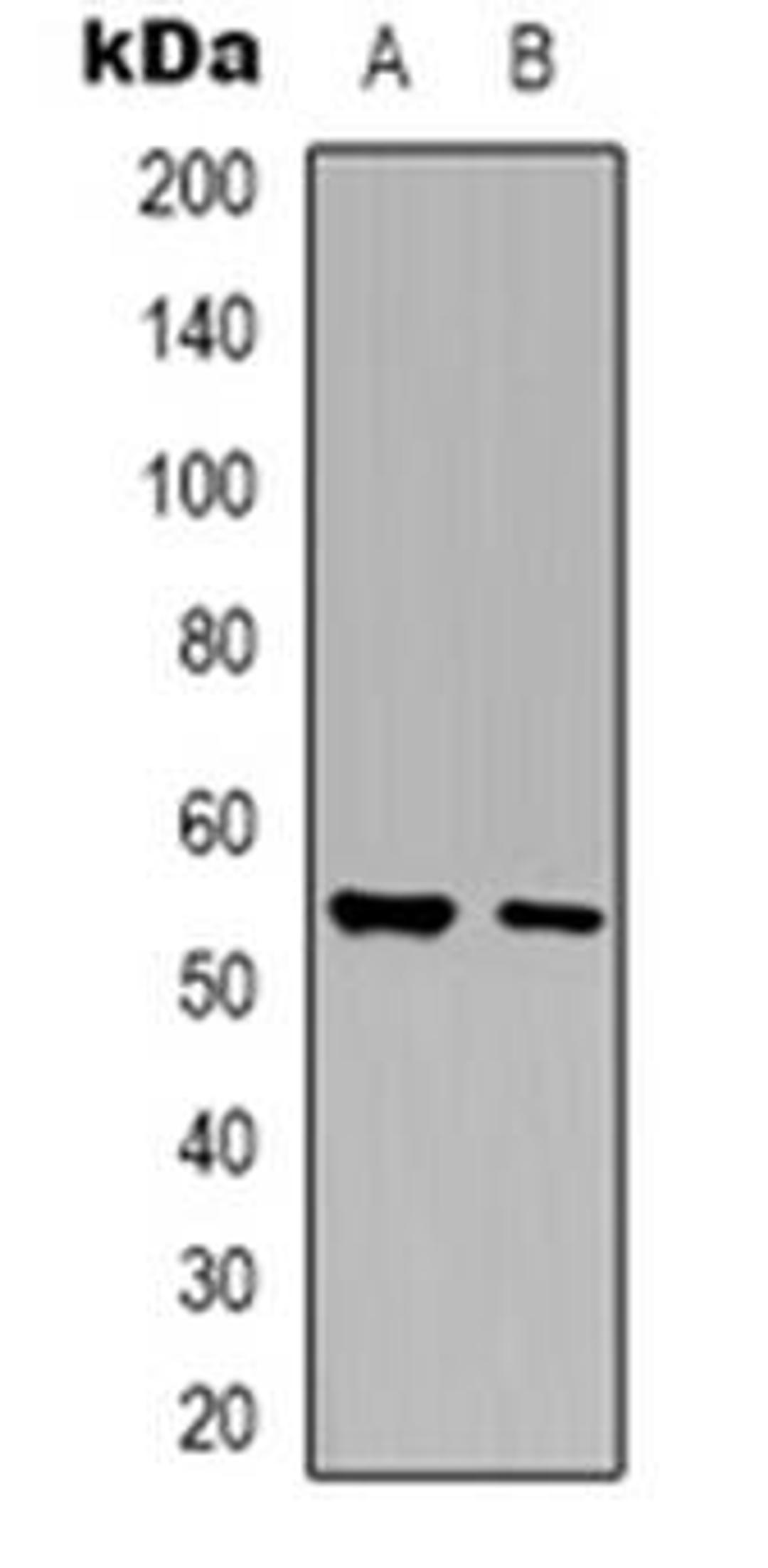 Western blot analysis of Glycerate Kinase expression in HepG2 (Lane 1), NIH3T3 (Lane 2) whole cell lysates using GLYCTK antibody