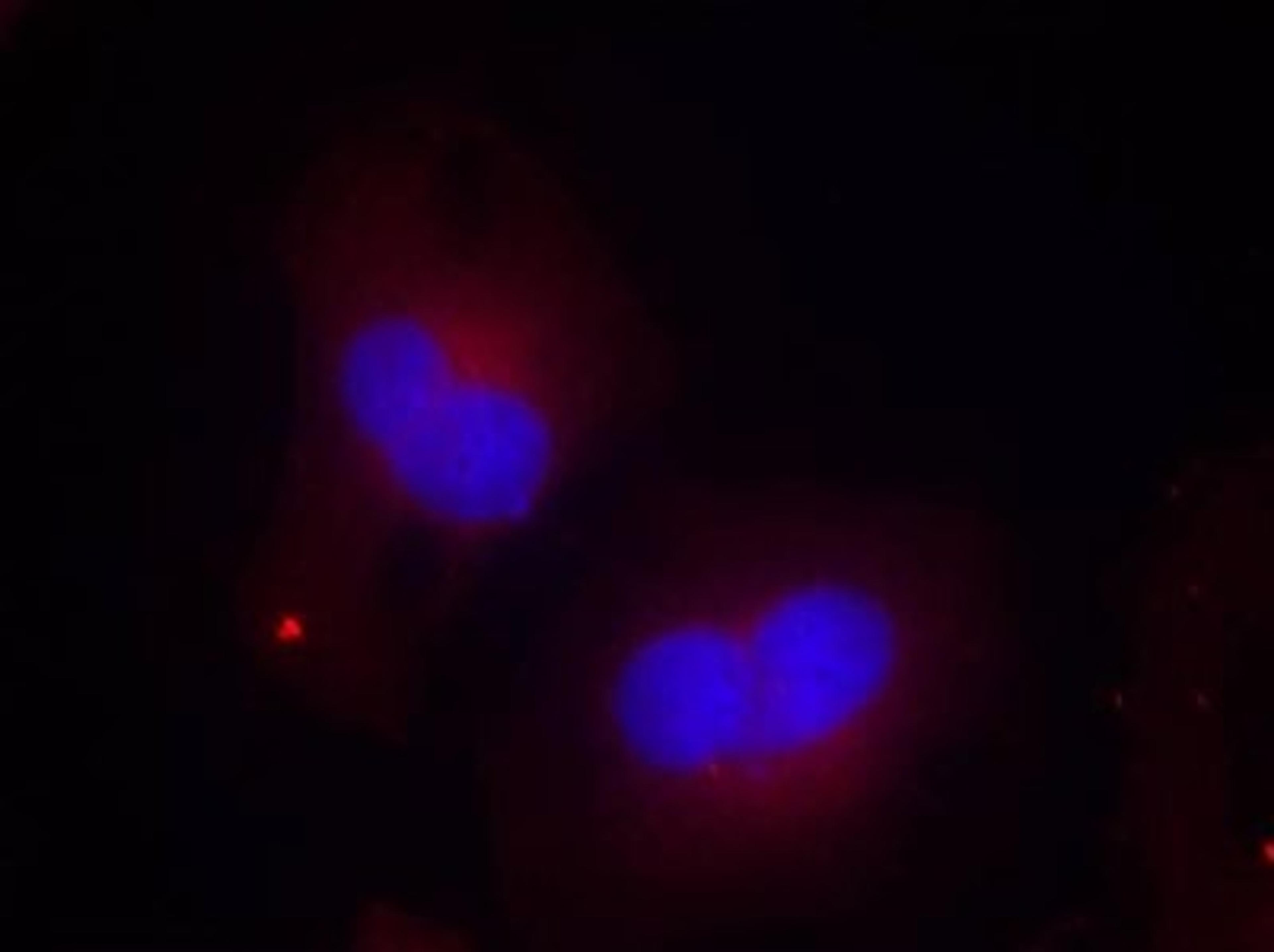 Immunocytochemistry/Immunofluorescence: FAK [p Tyr925] Antibody [NB100-81922] - Staining of methanol-fixed Hela cells using FAK(Phospho-Tyr925) antibody