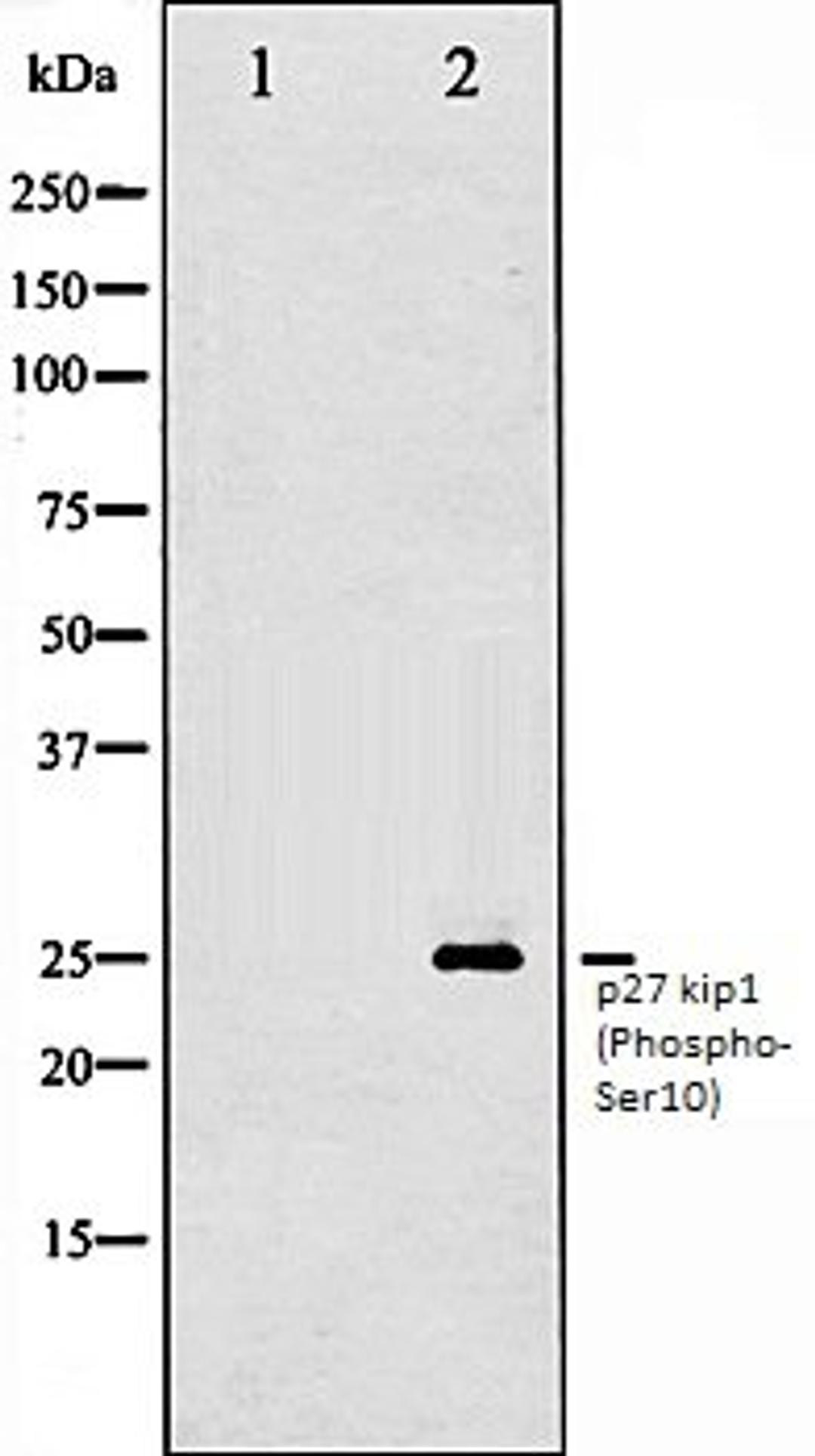 Western blot analysis of A2780 whole cell lysates using p27 Kip1 (Phospho-Ser10) antibody, The lane on the left is treated with the antigen-specific peptide.