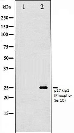 Western blot analysis of A2780 whole cell lysates using p27 Kip1 (Phospho-Ser10) antibody, The lane on the left is treated with the antigen-specific peptide.